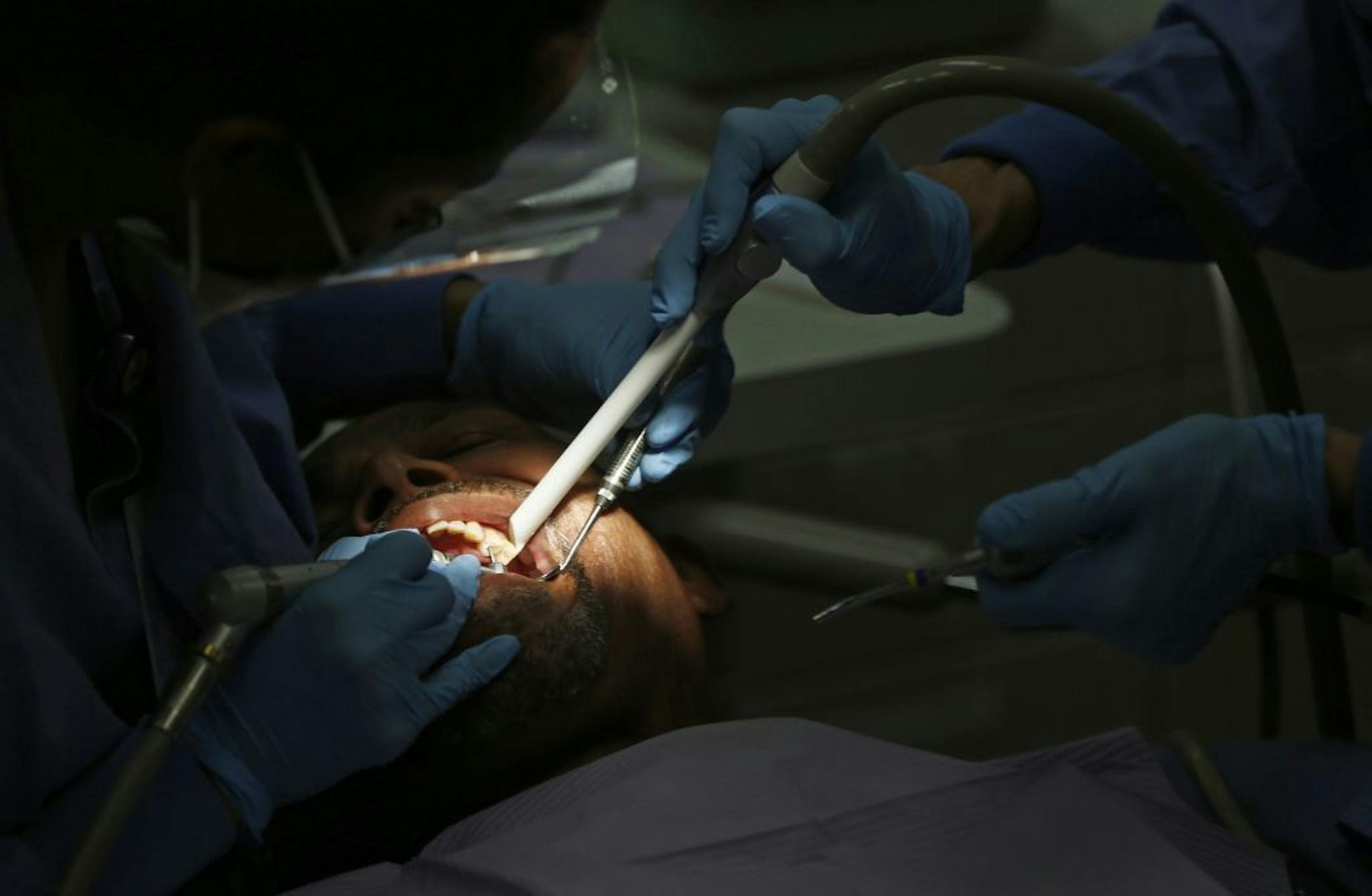 At the dental offices of HCMC, resident dentist Asmeret Tefahun worked on a filling for a patient who had insurance. Larger medical issues can stem from indigent who receive little or no dental care.