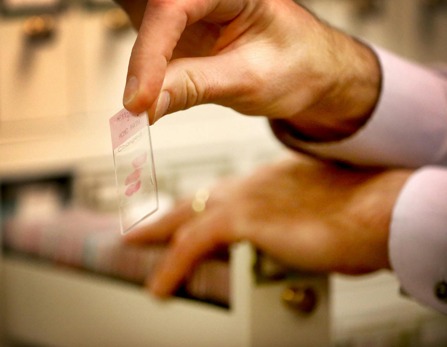 Chief Medical Examiner Dr. Andrew Baker holds a slide with a lung tissue sample extracted during an autopsy and stored in the vault at the Hennepin County Medical Examiner's office Thursday, June 28, 2015 in Minneapolis, MN. In unsolved murder cases, such tissue samples can yield DNA samples that might help solve the case.](DAVID JOLES/STARTRIBUNE)djoles@startribune.com Families visiting the medical examiner's office for the traumatizing experience of identifying a loved one must search for park