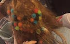 Amazon customer Benjamin Clark posted this image of Bunchems stuck in his daughter's long hair in his one-star review of the toy on the retailer's web