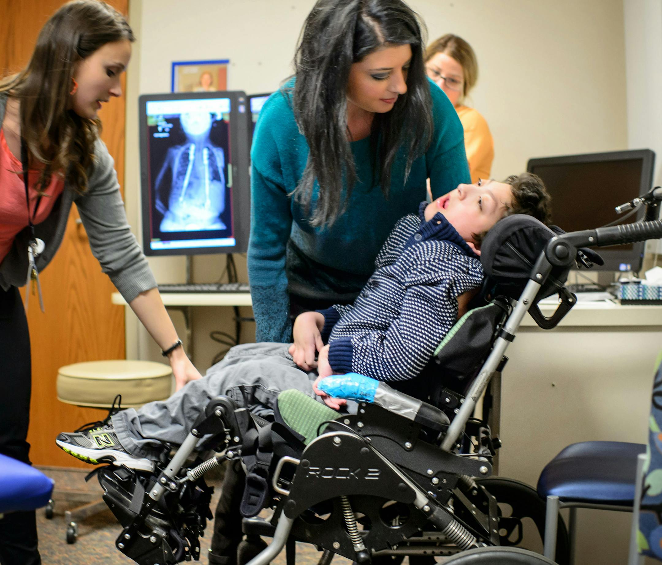 Elee Hruza, center and nurse practitioner Laura Tillman, left, moved Javier back to his wheelchair after Dr. Tenner Guillaum expanded the rods that are straightening his spine, curved by scoliosis. The procedure was painless and lasted under a minute. ] GLEN STUBBE * gstubbe@startribune.com Wednesday, March 18, 2015 A new magnetically controlled device for young kids with severe scoliosis is preventing expensive and traumatic pediatric surgeries. The device is a spinal rod whose length doctors c