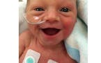 Preemie baby with adorable smile goes viral; 'she was happy to be alive'