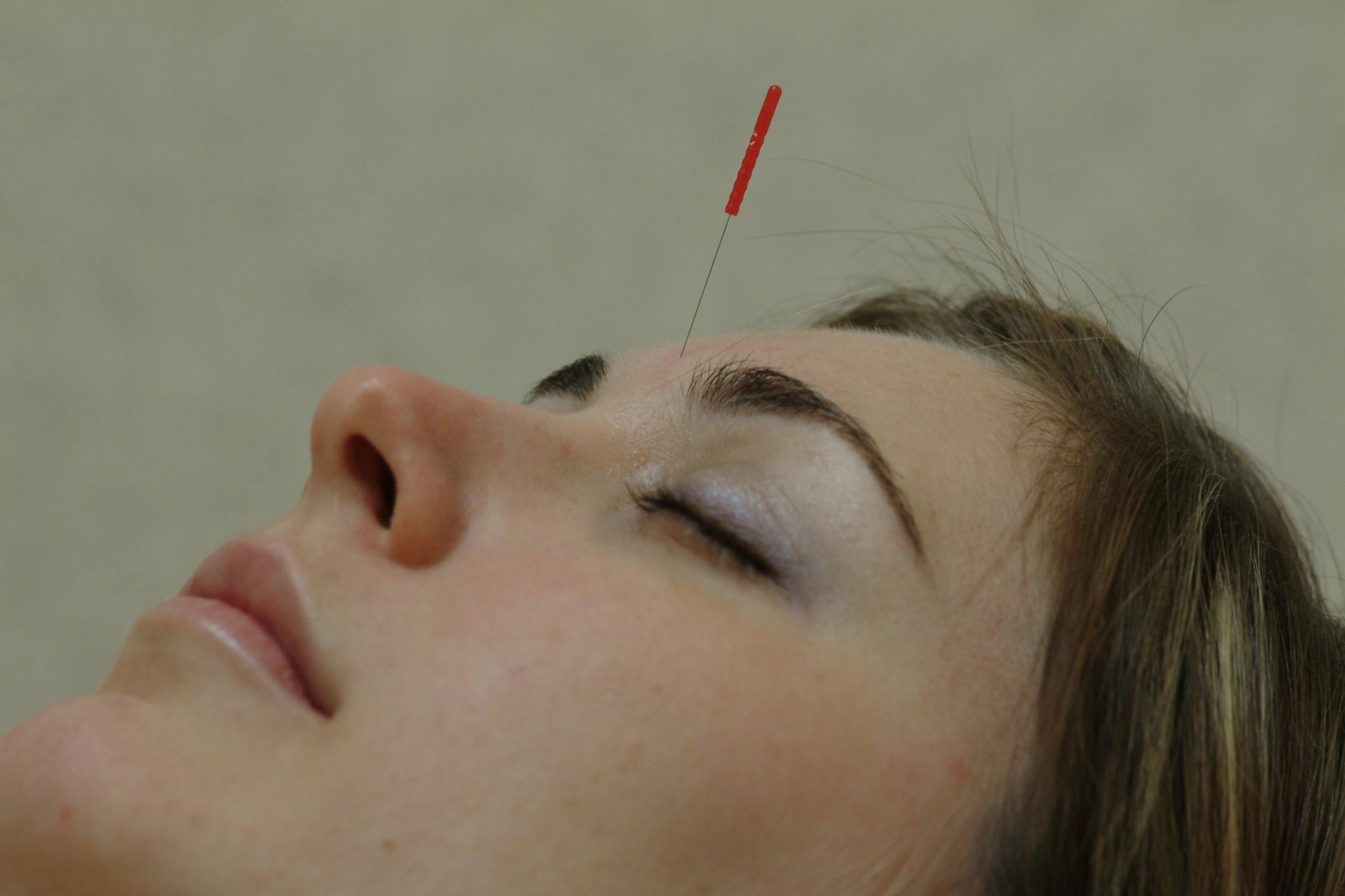 Therapies such as acupuncture and medical massage reduced self-reported pain levels by 47 percent and cut anxiety levels by 56 percent for cancer patients at Abbott Northwestern Hospital.