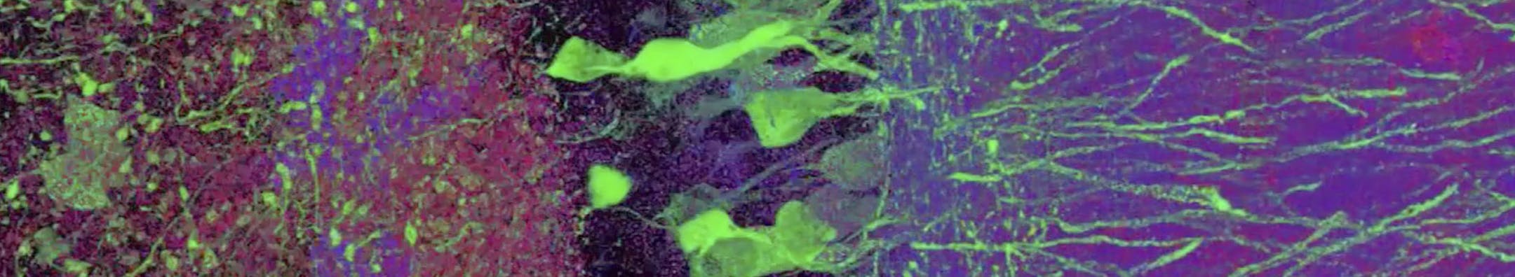An undated handout photo of an image of neurons in a mouse hippocampus taken with expansion microscopy. In a paper published last week in the journal Science, researchers at MIT said they were able to increase the physical size of cultured cells and tissue by as much as five times while still preserving their structure, using a new technique with regular optical microscopes. (Ed Boyden, Fei Chen, Paul Tillberg/MIT via The New York Times) -- NO SALES; FOR EDITORIAL USE ONLY WITH STORY SLUGGED SCI
