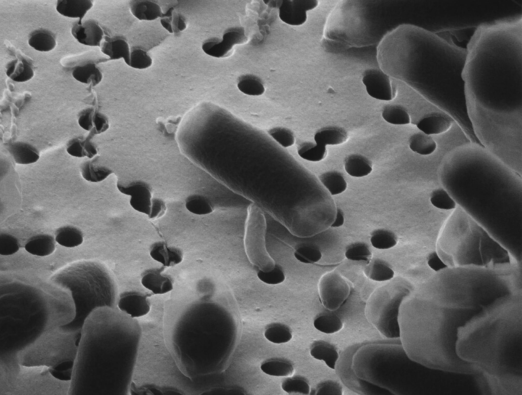 'Killing machines': Small, comma-shaped Bdellovibrio bacteriovorus entered its prey, the larger E. coli, in an image from Julia Johnke, Matthias Schmidt and Nedal Said. Microbiologists say predatory bacteria are "very efficient killing machines."