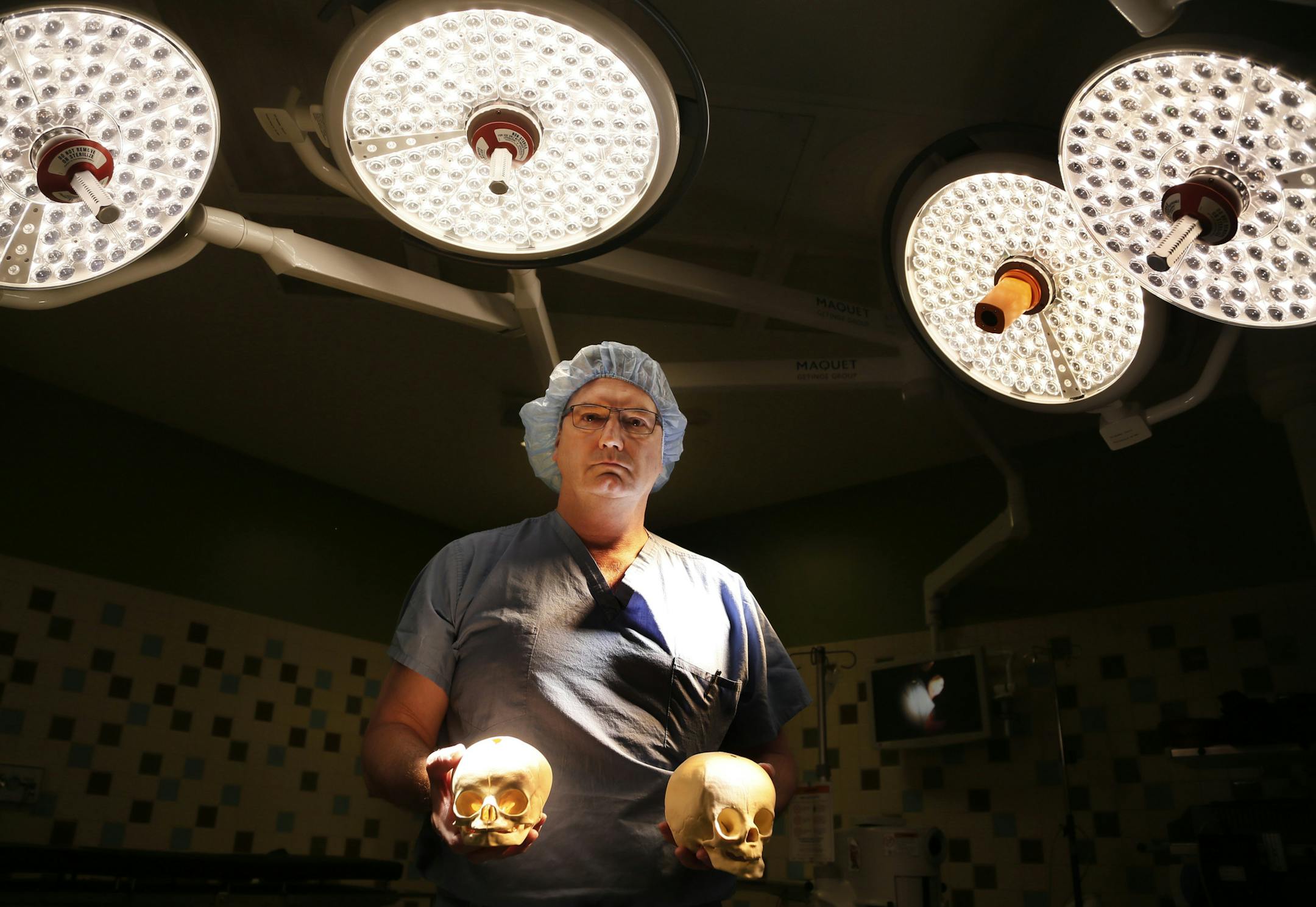 Dr. Robert Wood, a Gillette Children's physician who reconstructs the skulls of babies born with birth defects, has pioneered a new method that eliminates the need for transfusions, reducing costs and potential for damage. Thursday May 1, , 2014 in Minneapolis, MN. ] Jerry Holt Jerry.holt@startribune.com