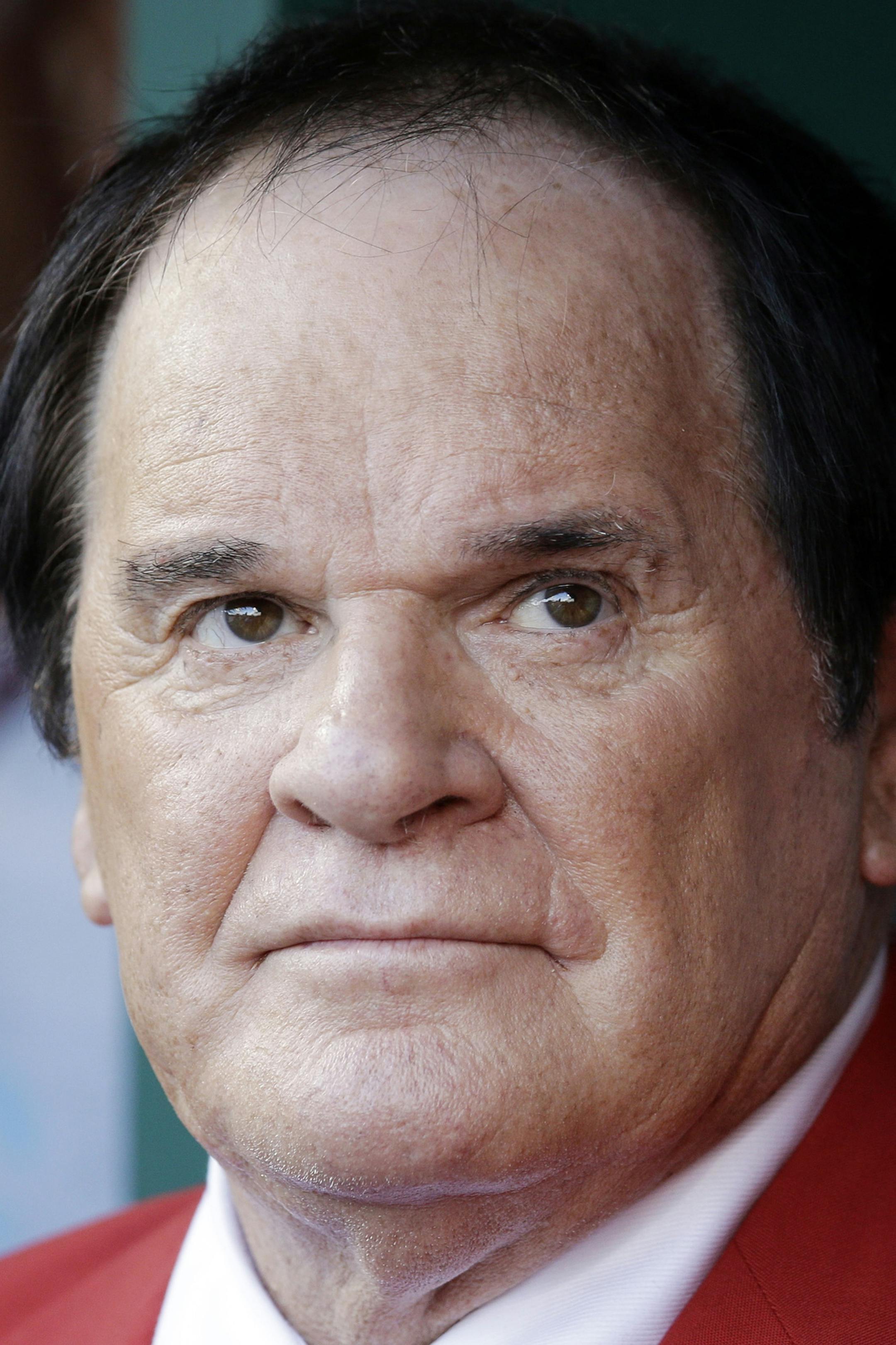 Former Cincinnati Reds' Pete Rose waits before being introduced as one of the team's Franchise Four before the MLB All-Star baseball game, Tuesday, July 14, 2015, in Cincinnati. (AP Photo/John Minchillo)