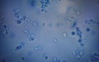 FILE -- Inactive Candida auris is seen on a screen at the Centers for Disease Control and Prevention, in Atlanta, Aug. 23, 2018. The rise of Candida a