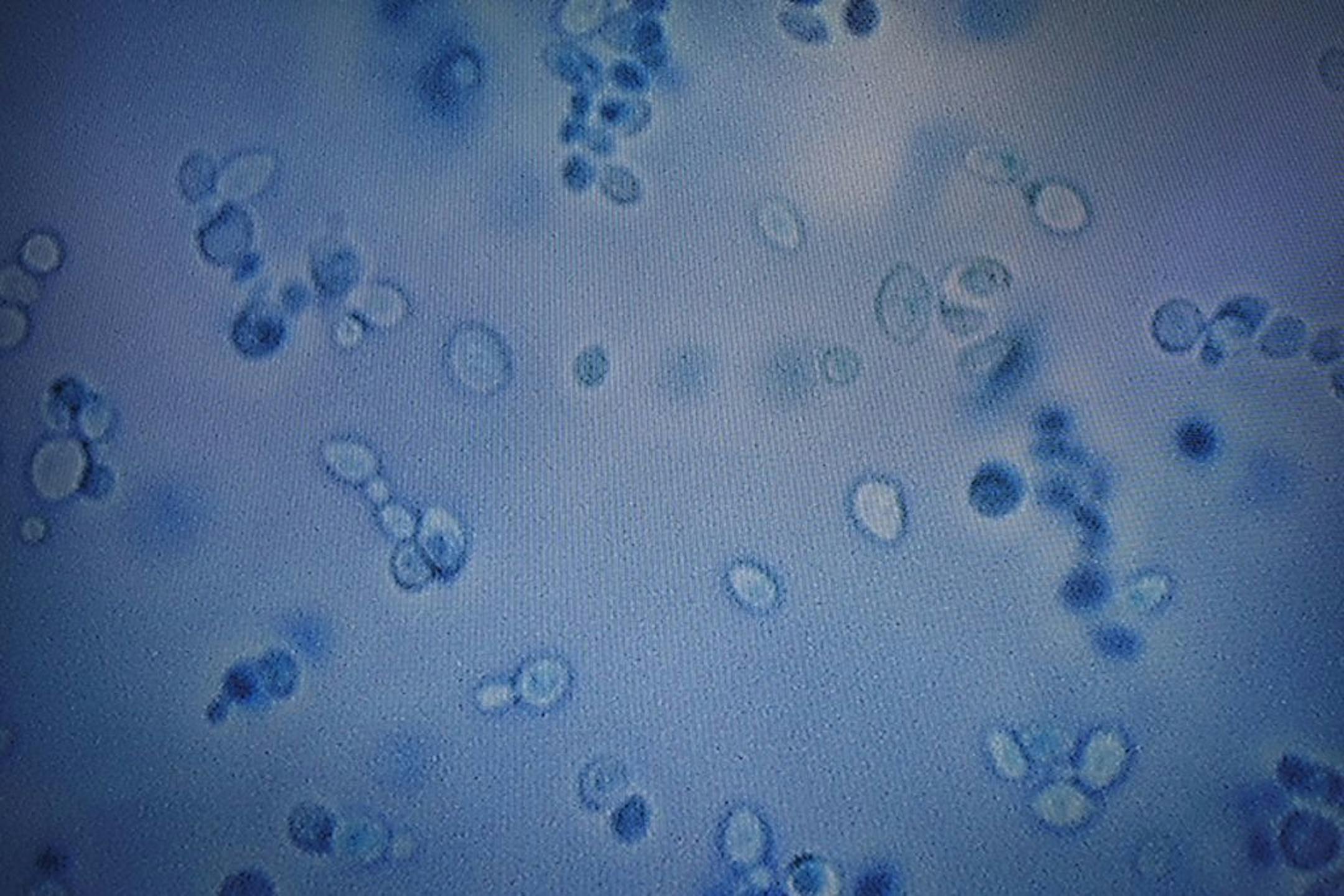 FILE -- Inactive Candida auris is seen on a screen at the Centers for Disease Control and Prevention, in Atlanta, Aug. 23, 2018. The rise of Candida auris embodies a serious and growing public health threat: drug-resistant germs.