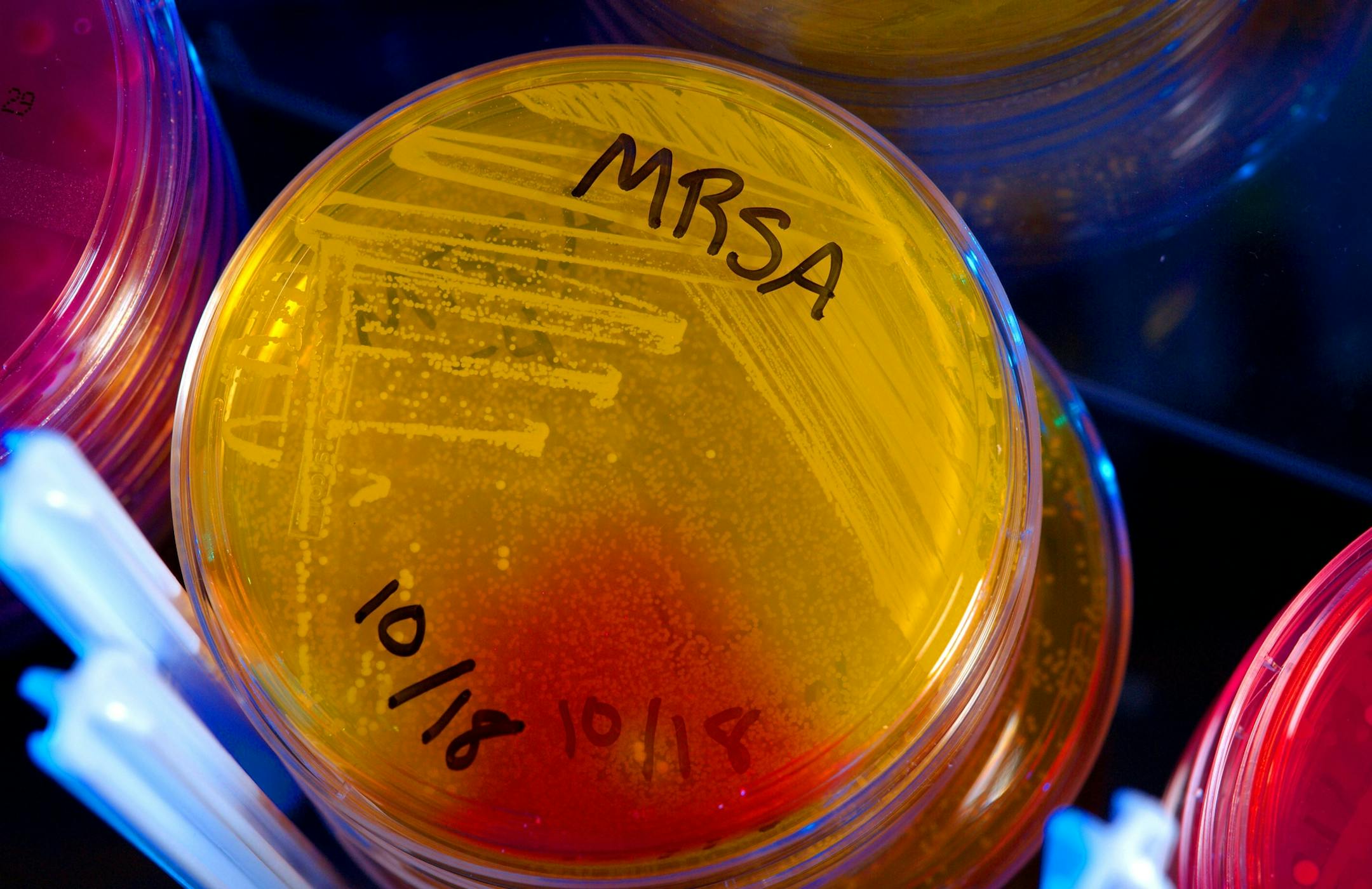 This undated photo provided by the Center for Disease Control (CDC) shows plates of Methicillin-Resistant Staphylococcus Aureus (MRSA).