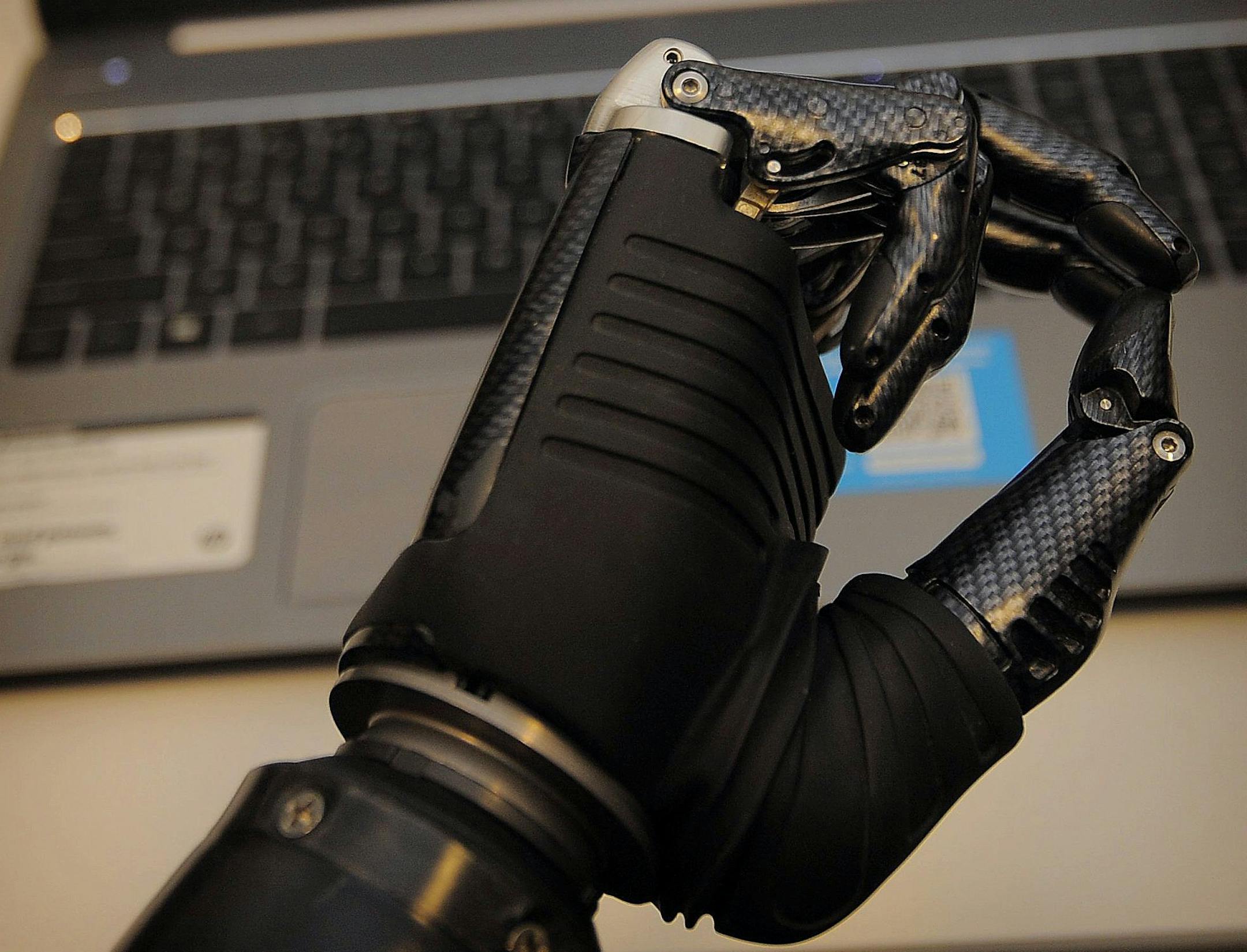 Quadruple amputee Anne Mekalian learns to use a thought-controlled prosthetic hand in Baltimore on Nov. 22, 2013. (Kim Hairston/Baltimore Sun/MCT)