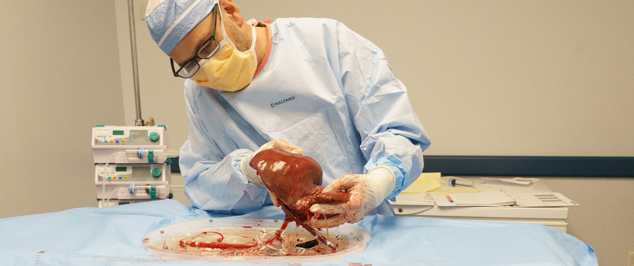 Dr. David J. Reich, center, a professor in chief of transplantation at Drexel University and Hahnemann University Hospital, shows the change in color after rejuvenating a donor liver that would otherwise be discarded, due to the length of time between harvesting and use, at the Gift of Life organ bank, in Philadelphia, Pa. on September 5, 2018. (Jessica Griffin/Philadelphia Inquirer/TNS)