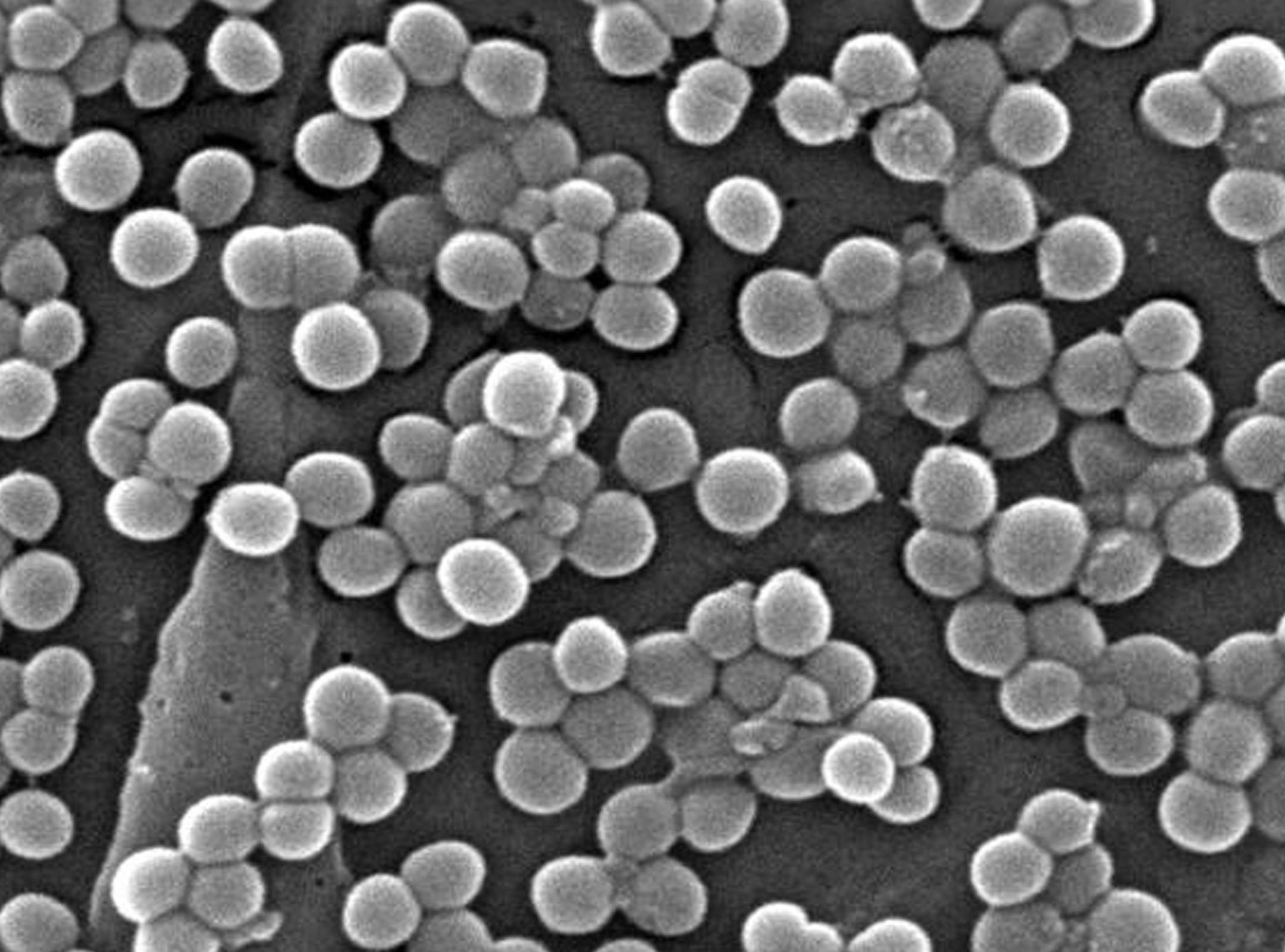 COURTESY CDC/ Janice Carr/ Jeff Hageman, M.H.S. This 2005 scanning electron micrograph (SEM) depicted numerous clumps of methicillin-resistant Staphylococcus aureus bacteria, commonly referred to by the acronym, MRSA; Magnified 9560x.