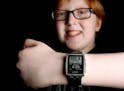 Joe Bensing, 14, has Type 1 diabetes and wears a Pebble smartwatch that displays data from a Dexcom continuous glucose monitor.