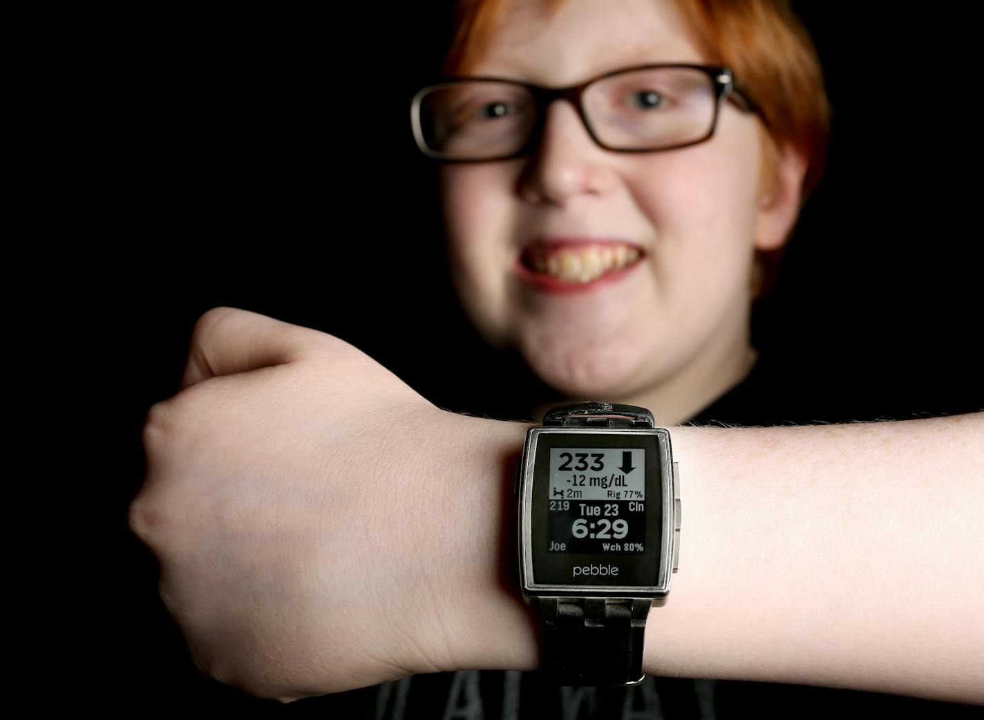 Joe Bensing, 14, has Type 1 diabetes and wears a Pebble smartwatch that displays data from a Dexcom continuous glucose monitor.