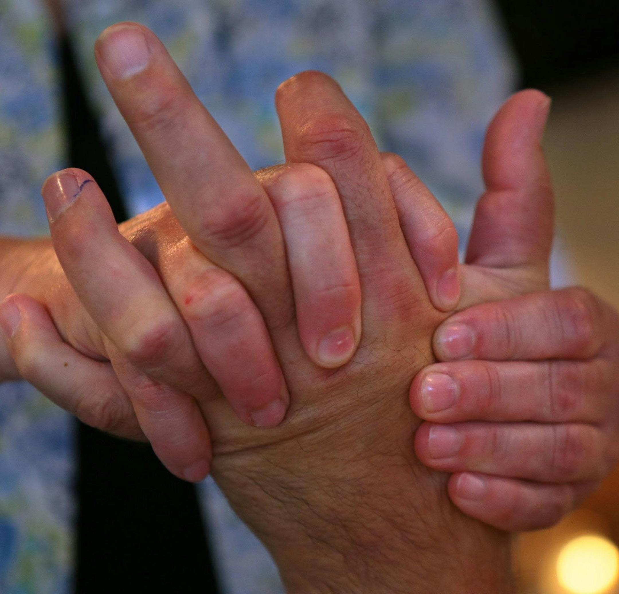 Dave Larson, who suffers from ALS, gets a treatment from massage therapist Kelly Sontheimer in St. Louis on July 1, 2014. Larson is undergoing the massage treatments to try to slow the atrophication of his muscles from the disease. (Robert Cohen/St. Louis Post-Dispatch/MCT)