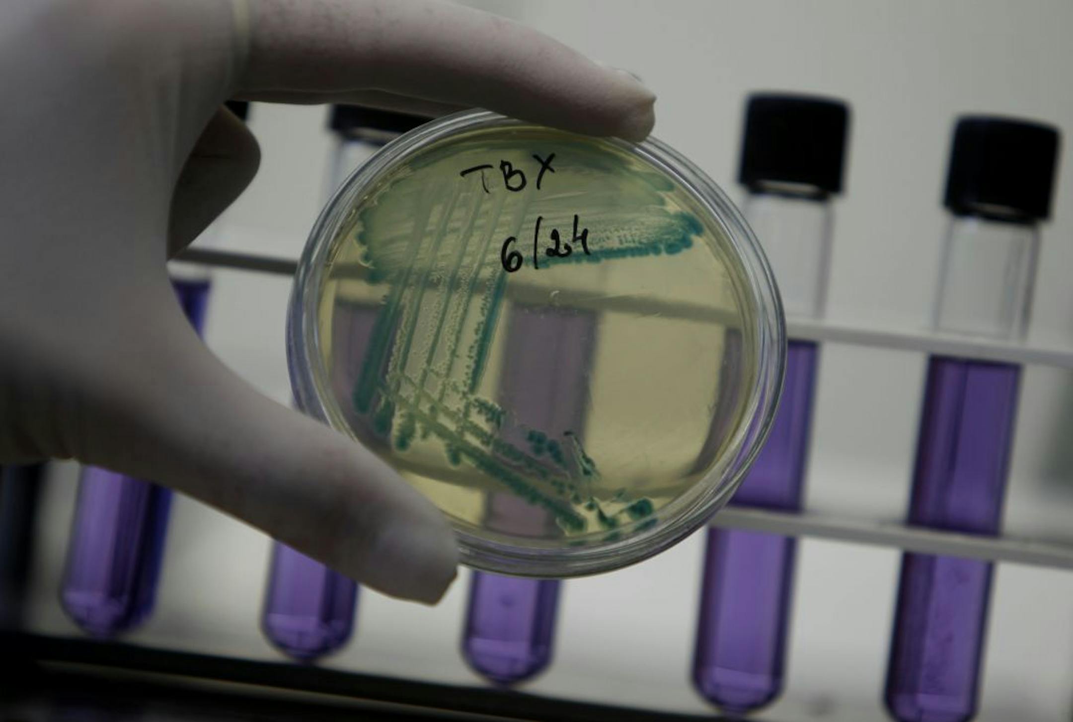 A laboratory technician shows isolated Escherichia coli bacteria at the Bulgarian Food Safety Agency's micro biological laboratory in Sofia, Bulgaria, Friday, June 10, 2011. German vegetables caused an E. coli outbreak that has killed 29 people and sickened 3,000, investigators announced Friday after tracking the bacteria from patients in hospital beds to restaurants and then farm fields.
