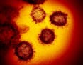 An image from an electron microscope shows SARS-CoV-2, the virus that causes COVID-19. Scientists say this version of the coronavirus has mutated and 