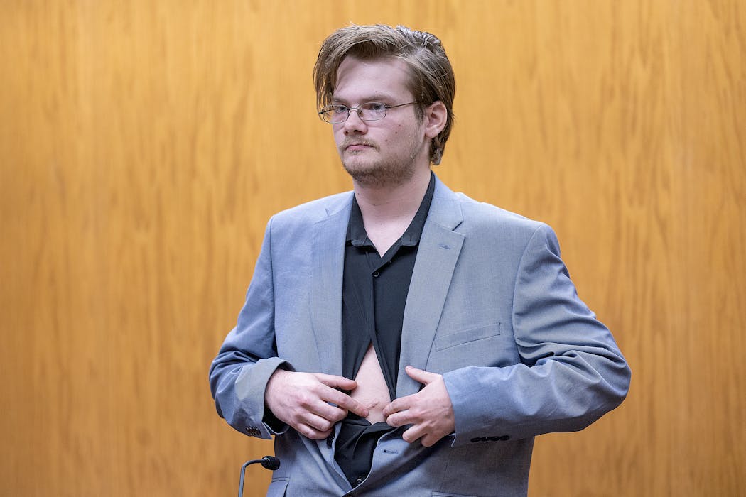 Witness and victim Dante Carlson shows his stabbing scar on the stand during the second day of the trial against Nicolae Miu at the St. Croix County Circuit Court in Hudson, Wis., on Tuesday. 