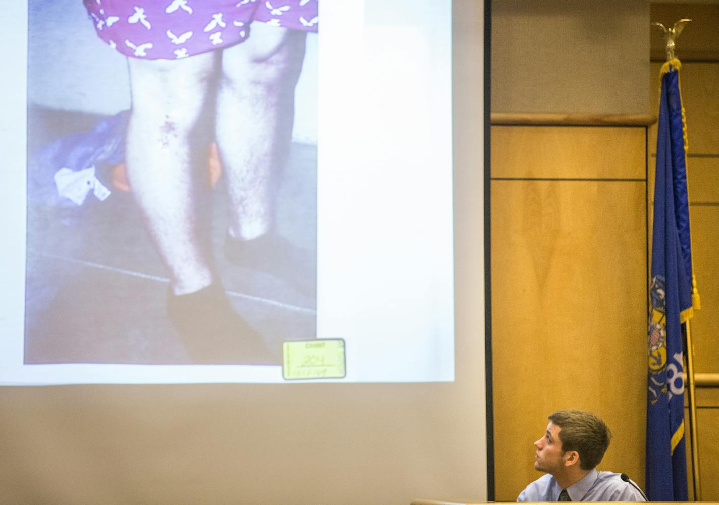 Levi Acre-Kendall looks at evidence displayed of a photo of lacerations on his leg while testifying in Polk County Circuit Court in Balsam Lake on Friday, December 11, 2015. ] (Leila Navidi/Star Tribune) leila.navidi@startribune.com BACKGROUND INFORMATION: The murder trial of Levi Acre-Kendall, a Minnesota man charged with killing Wisconsin resident Peter S. Kelly after a dispute along the St. Croix River.