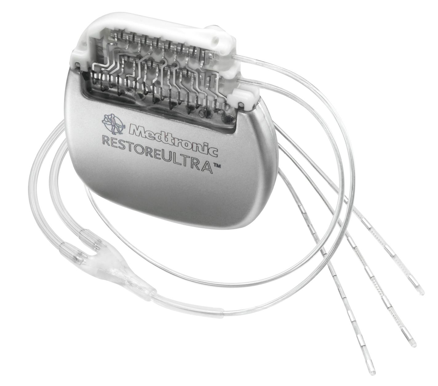 Medtronic's RestoreULTRA neurostimulation system gives patients ability to send pain-relieving stimulation to specific areas near the spinal cord for relief of back and leg pain.