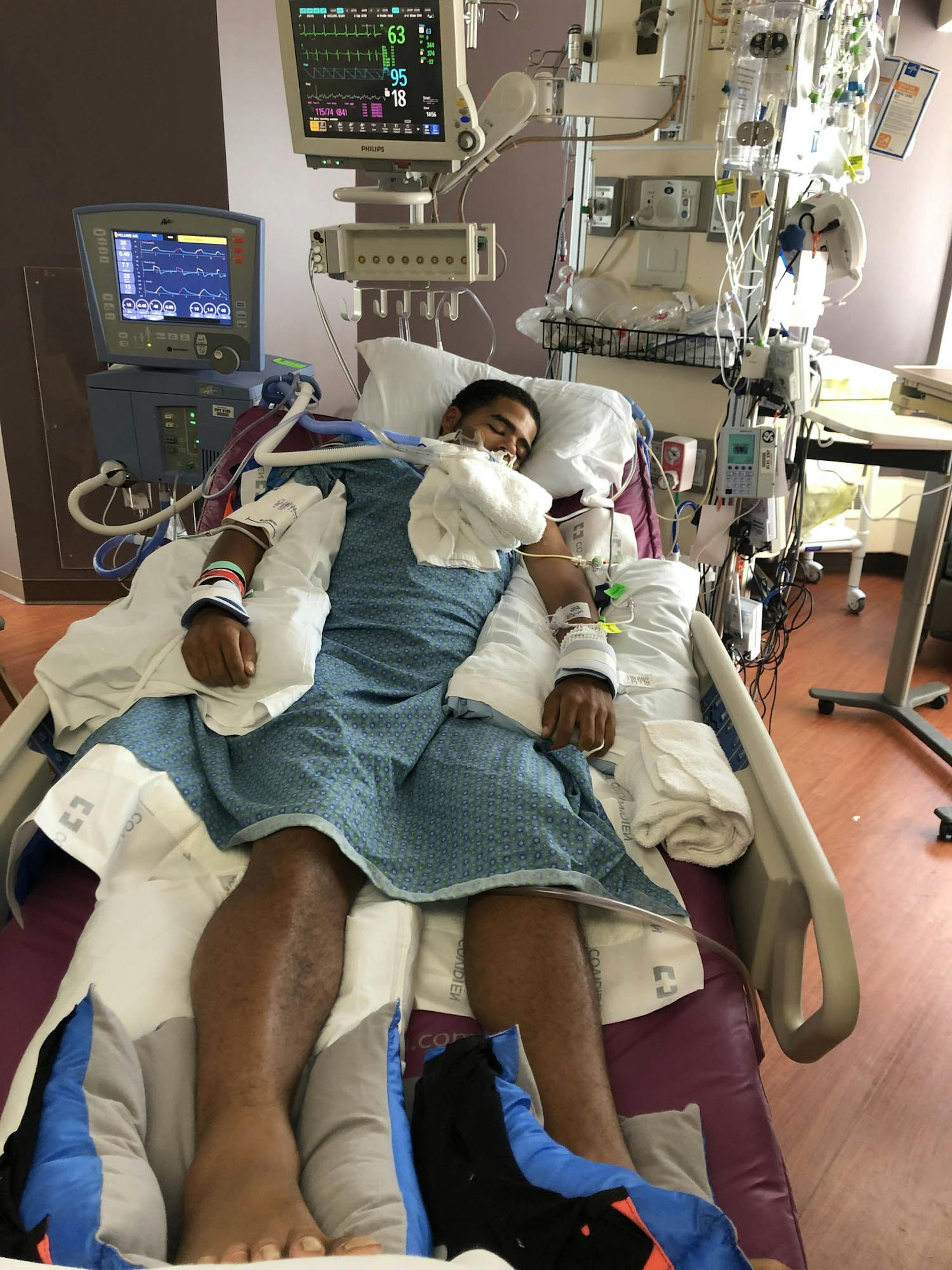 Elijah McClure, 21, has been in intensive care and on mechanical ventilation at North Memorial Medical Center for 11 days since suffering a vaping-associated lung injury.