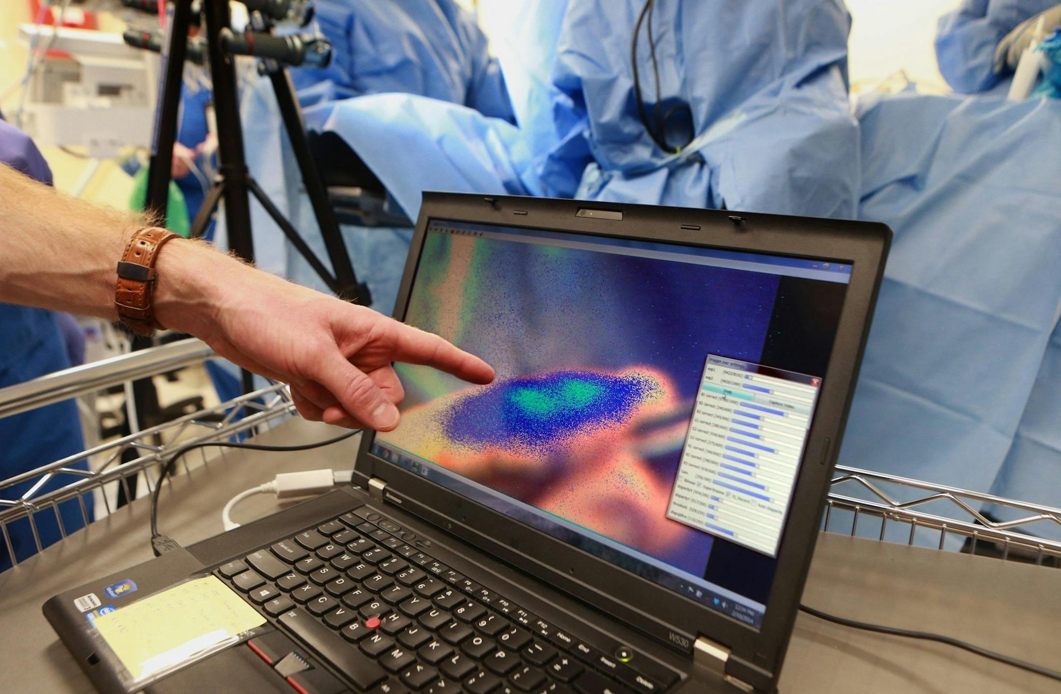 Ryan Fields, left, a Washington University oncological surgeon at the Siteman Cancer Center, points to an image of what surgeon Julie Margenthaler sees on Monday, Feb. 10, 2014, using a type of worn visual device that can see a fluorescent compound injected into the tissue during an operation to remove a lymph node on 67-year-old Karen Clodfelter. A fluorescent shows the boundaries of potential tumors and gives a more accurate view. (Christian Gooden/St. Louis Post-Dispatch/MCT)