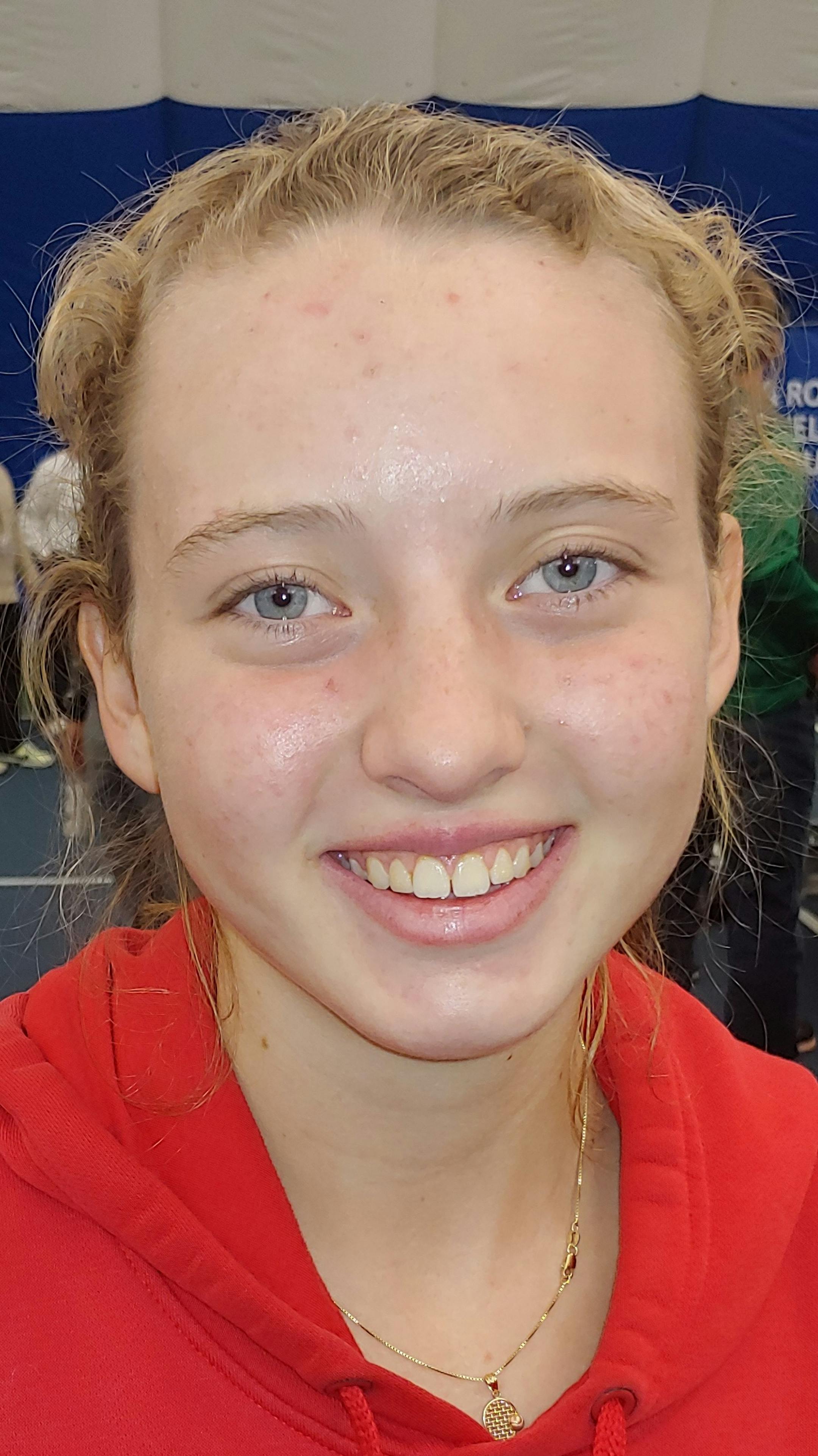 Isabelle Einess of Breck