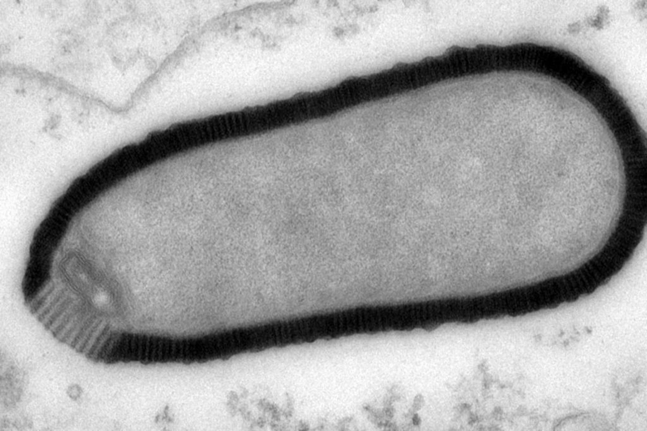 An electron microscope image shows a section of a Pithovirus particle, dark outline, inside an infected Acanthamoeba castellanii cell. The length of the particle is about 1.5 microns with a 0.5 micron diameter.