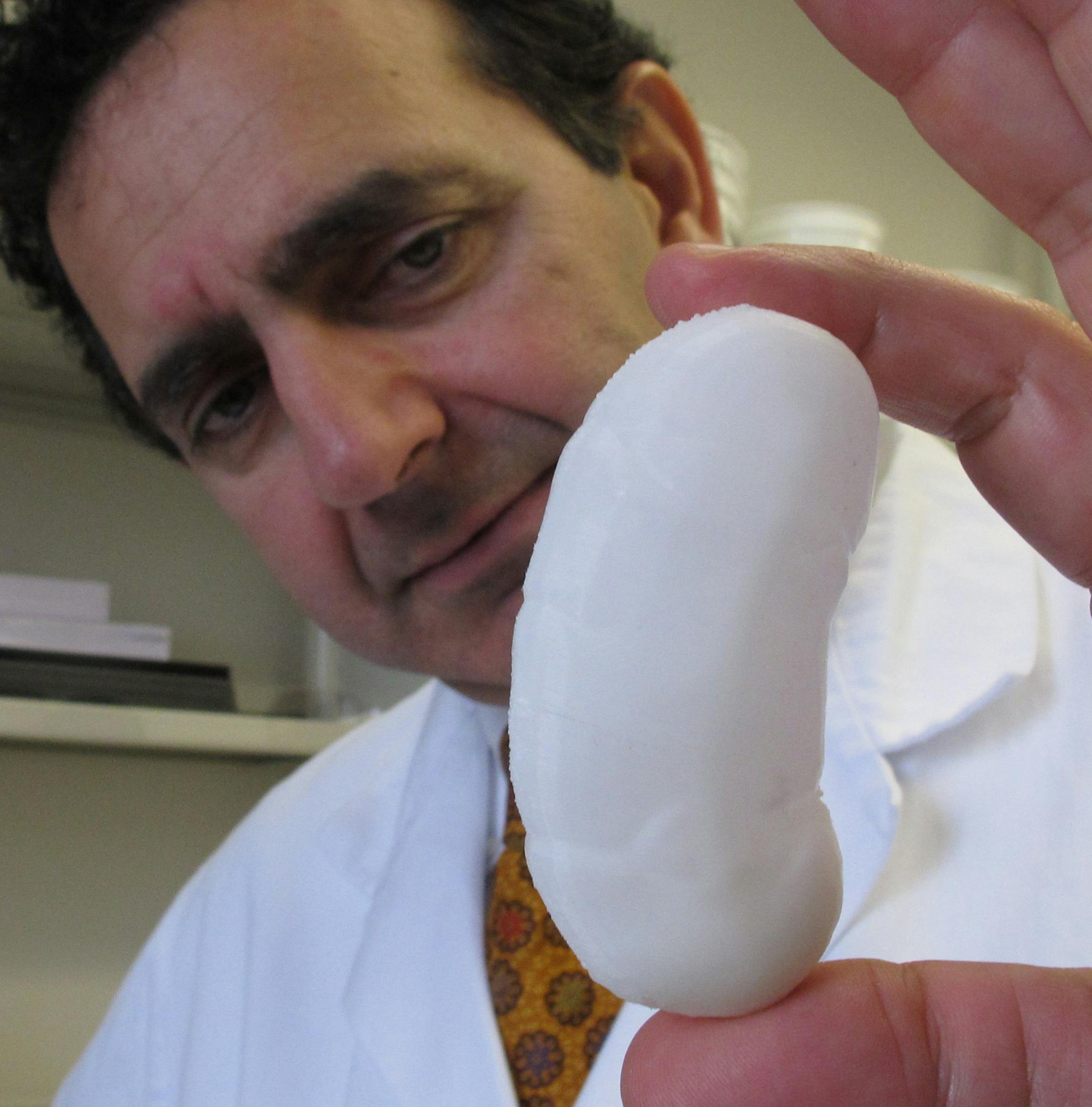 Dr. Anthony Atala held the scaffolding for a human kidney created by a 3-D printer