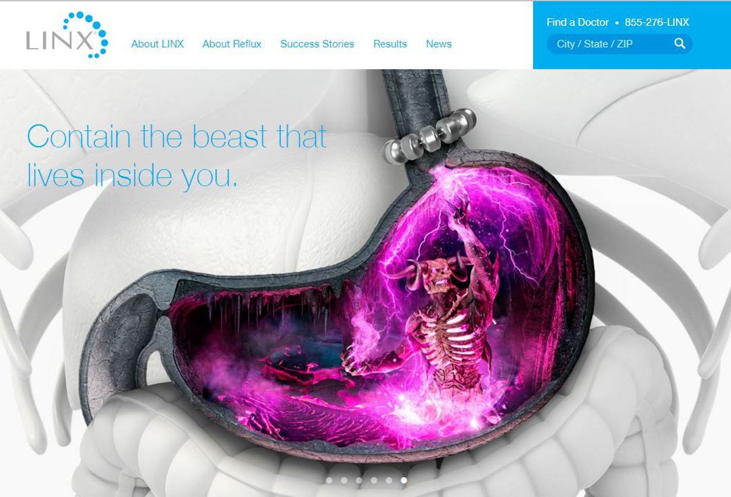 Eye-catching: Torax Medical's Linx device treats acid reflux disease by using magnets to clamp down on the lower esophagus when drugs and natural bodily mechanisms can't control stomach acid. The company hopes the colorful ads, depicting what acid-reflux-sufferers say the disease feels like, will get people to go to the website and ask their doctors about the therapy.