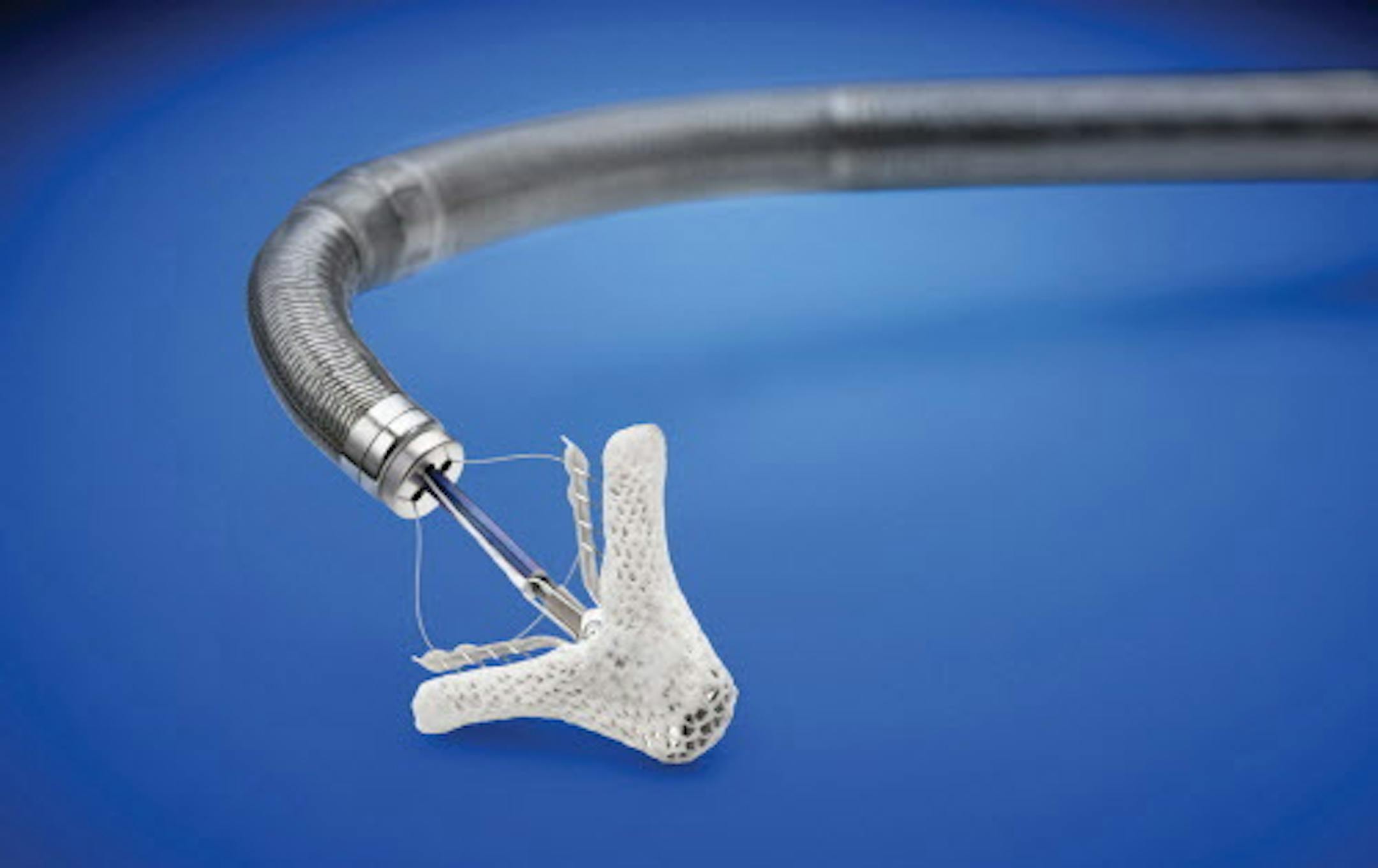 MitraClip device from Abbott Laboratories. The story MITRAL122113