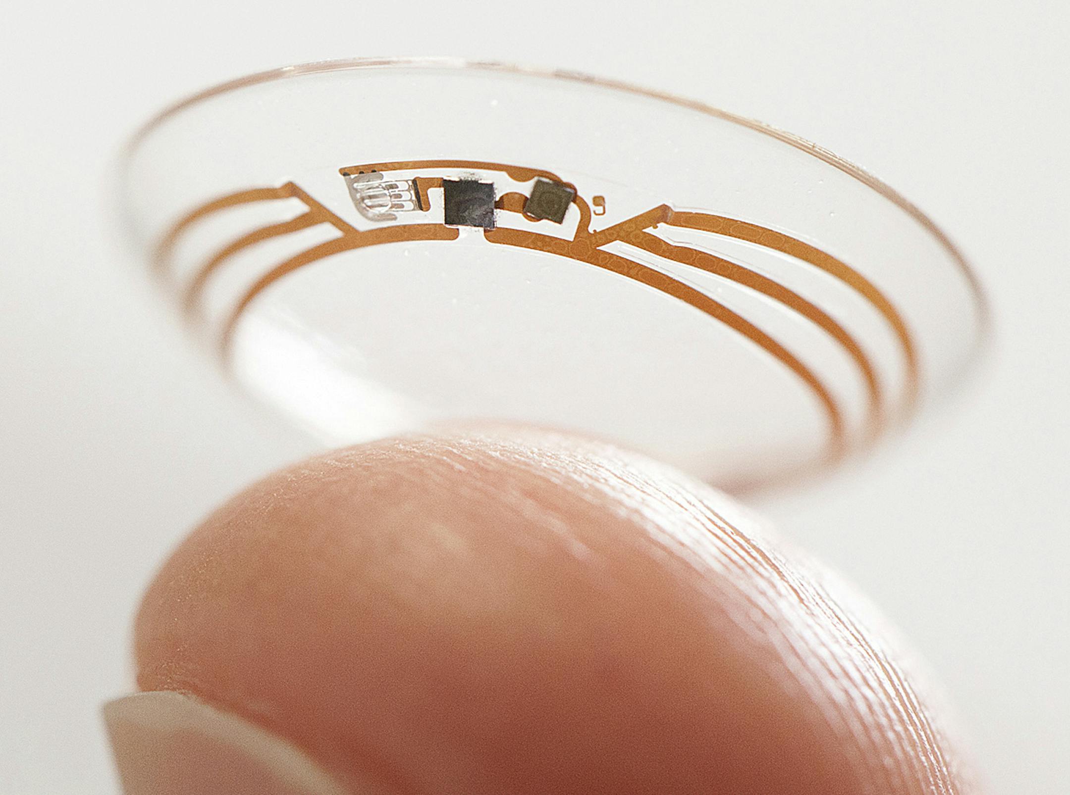 This undated photo released by Google shows a contact lens Google is testing to explore tear glucose. After years of scalding soldering hair-thin wires to miniaturize electronics, Brian Otis, Google X project lead, has burned his fingertips so often that he can no longer feel the tiny chips he made from scratch in Googleís Silicon Valley headquarters, a small price to pay for what he says is the smallest wireless glucose sensor that has ever been made. (AP Photo/Google)