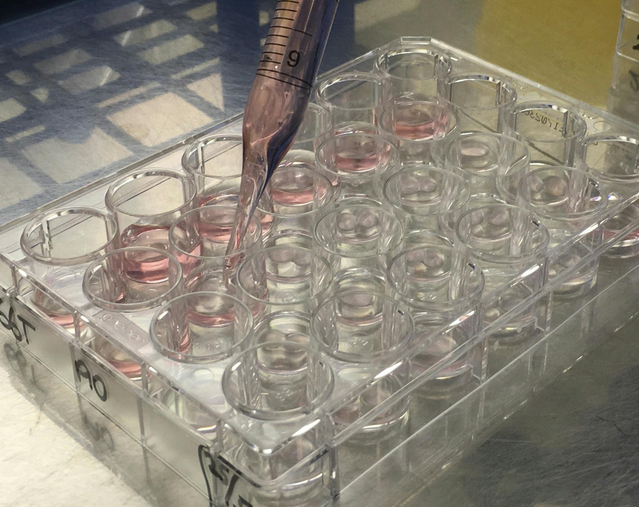 Samples of mini organs are prepared at the Hubrecht Institute in Utrecht, Netherlands on Monday, May 29, 2017. Doctors in the Netherlands are aiming to grow mini intestines for every Dutch cystic fibrosis patient to figure out what drugs might work for them. Researchers around the world are making mini kidneys, livers and brains to study how organs mature and provide clues on how certain diseases might be treated. (AP Photo/Aleksandar Furtula)