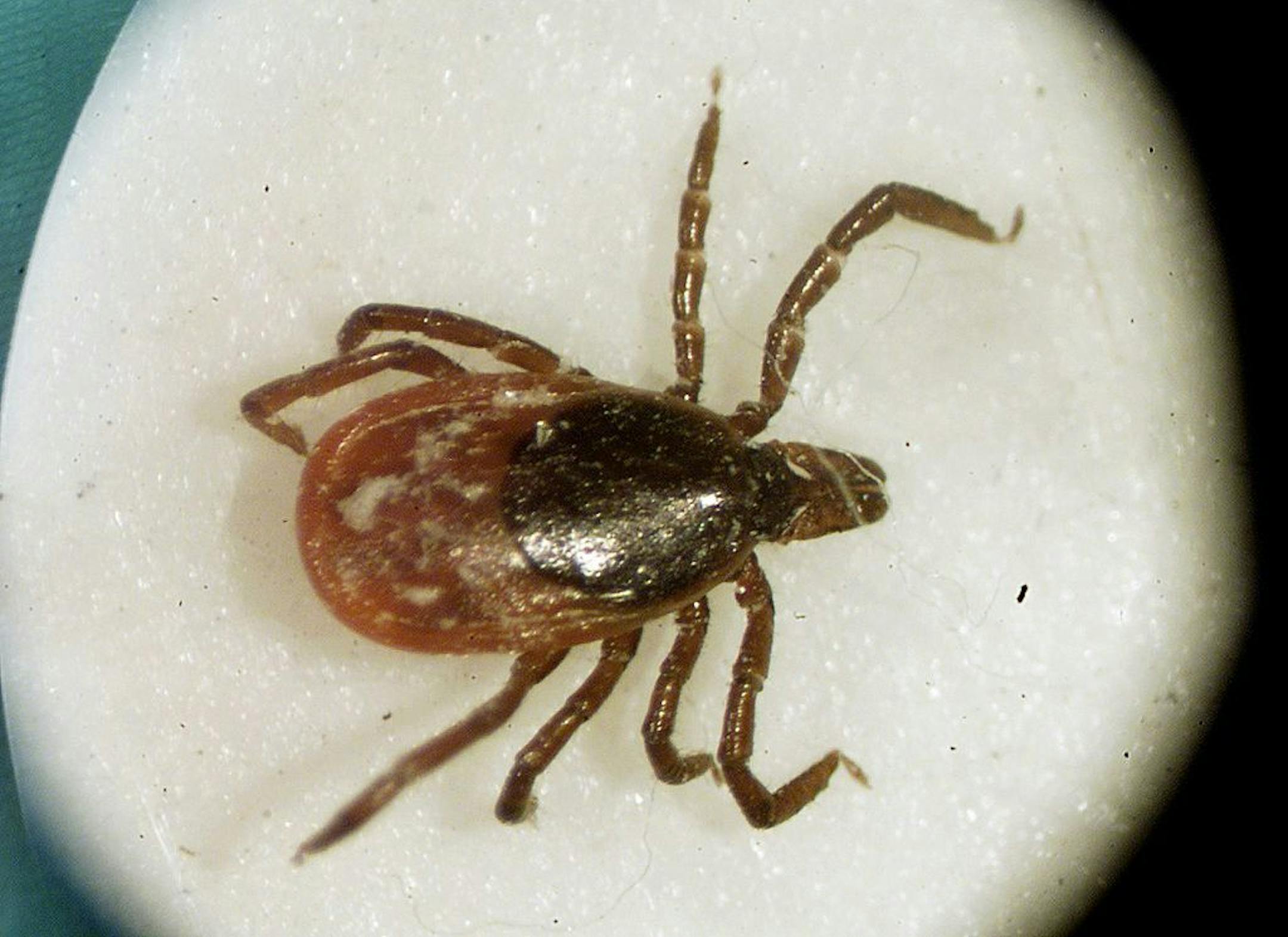 A deer tick is seen under a microscope in the entomology lab at the University of Rhode Island in South Kingstown, R.I.