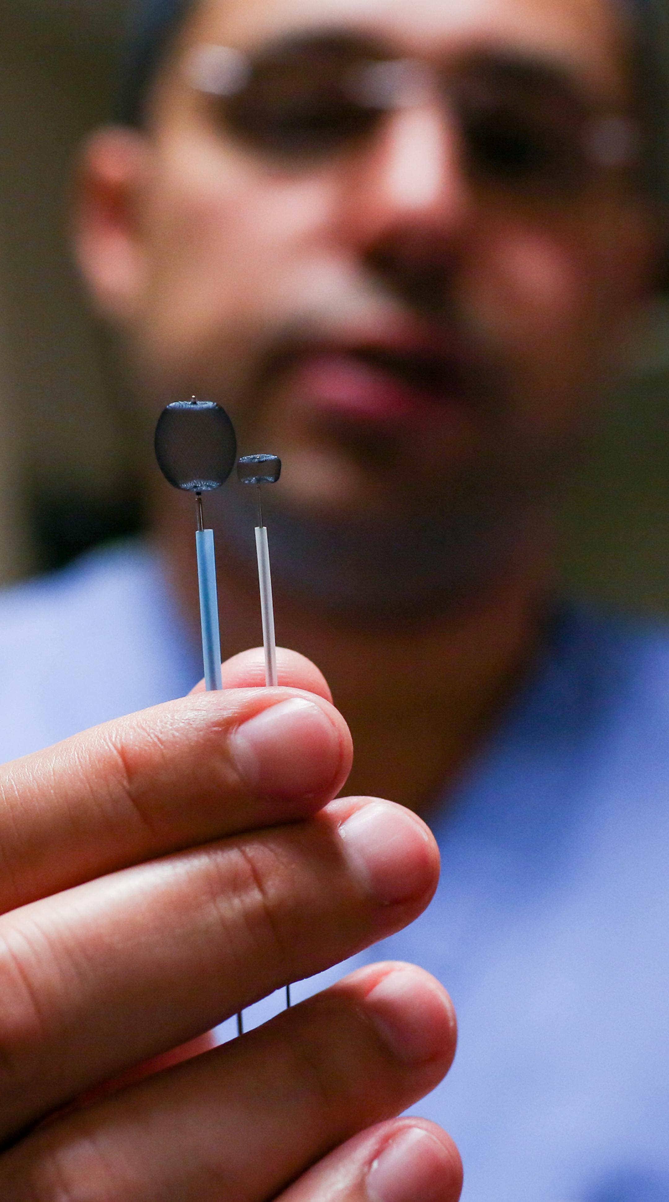 Neurointerventional Radiologist Dr. Josser Delgado, MD shows web devices used for preventive surgery on brain aneurysms. ] COURTNEY PEDROZA • courtney.pedroza@startribune.com June 13, 2017 Minneapolis, MN Abbott Northwestern Hospital; performed by Dr. Josser Delgado, MD; patient Terri Hopp; preventive surgery on a brain aneurysm