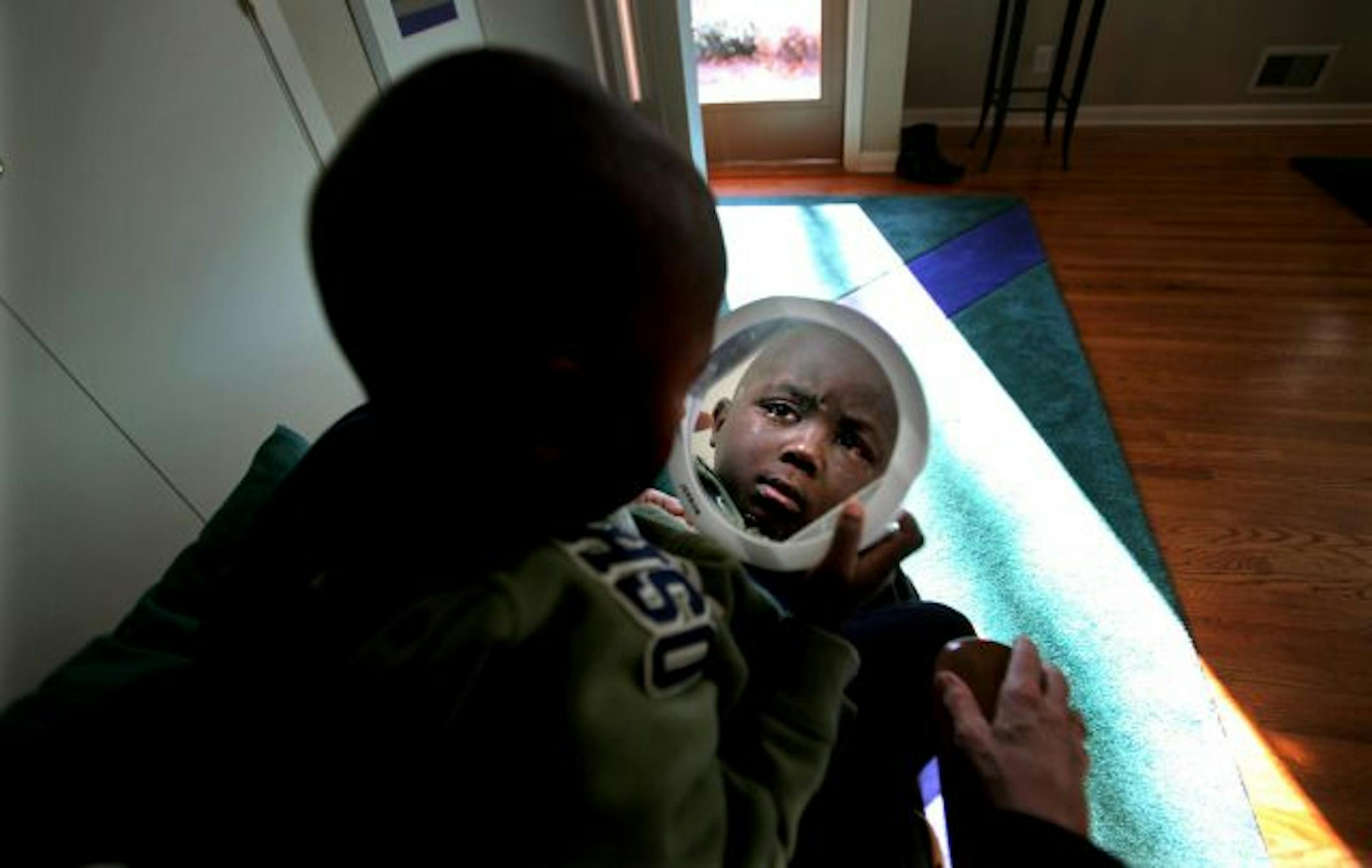 At first, Moses Mwaura, 5, was afraid to open his eyes. He has had a whirlwind week, flying from Kenya to Minnesota for surgery to correct severely crossed eyes. Eventually, he asked for a mirror. His hosts report that he is examining everything up close now.