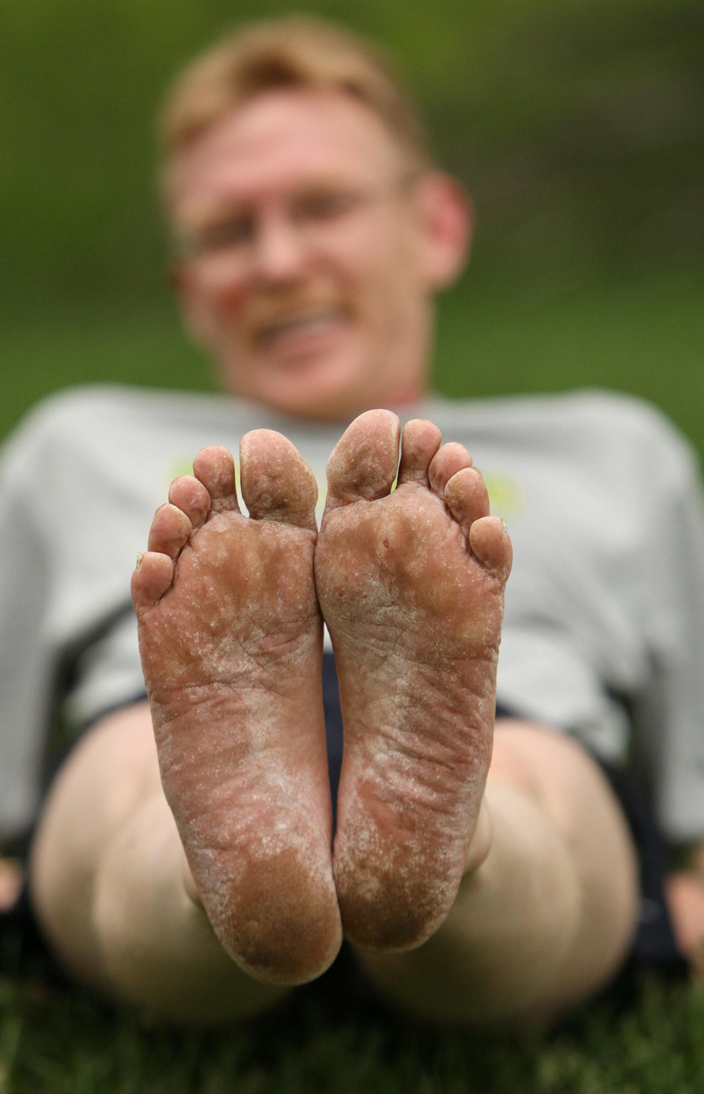 Dean Laiti's feet after his training run, mostly on asphalt paths, Tuesday evening.