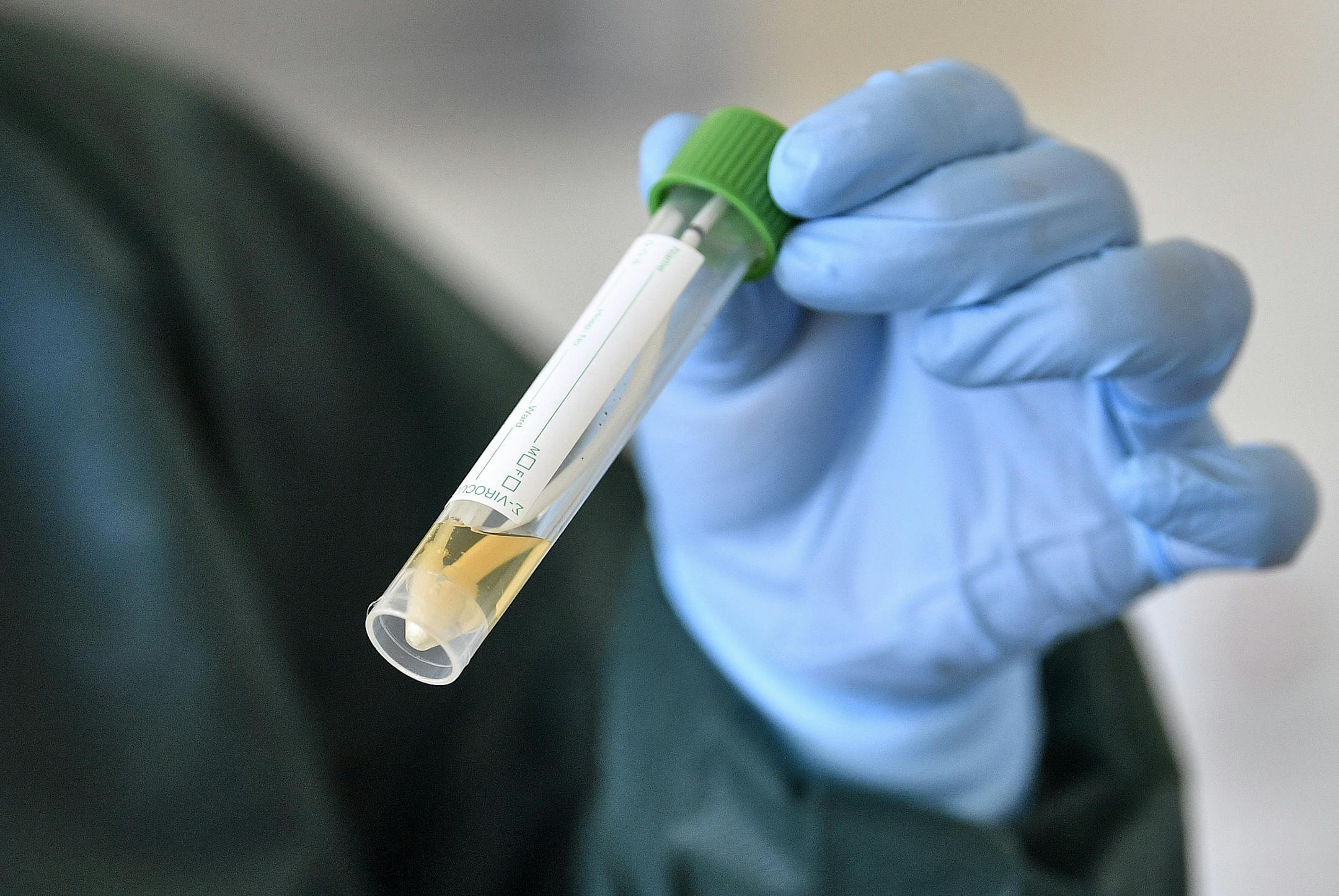 A nurse demonstrates taking a sample for a coronavirus test at the infection station of the university hospital in Essen, Germany, Thursday, March 12, 2020. The vast majority of people recover from the new coronavirus. According to the World Health Organization, most people recover in about two to six weeks, depending on the severity of the illness. (AP Photo/Martin Meissner)