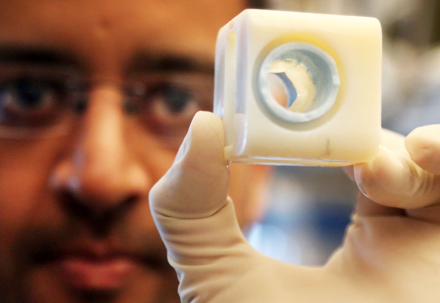 The University of Minnesota Biomedical Engineering department, led by Bob Tranquillo, is working on pediatric replacement heart valves made of human tissue. These new heart valves would be revolutionary, because they would grow with the human body and could eliminate the need for multiple surgeries for a child born with a heart valve defect. Here, Zeeshan Syedain, a University of Minnesota senior research associate, with a heart valve made from sheep tissue and seen Wednesday, Dec. 9, 2015, at t