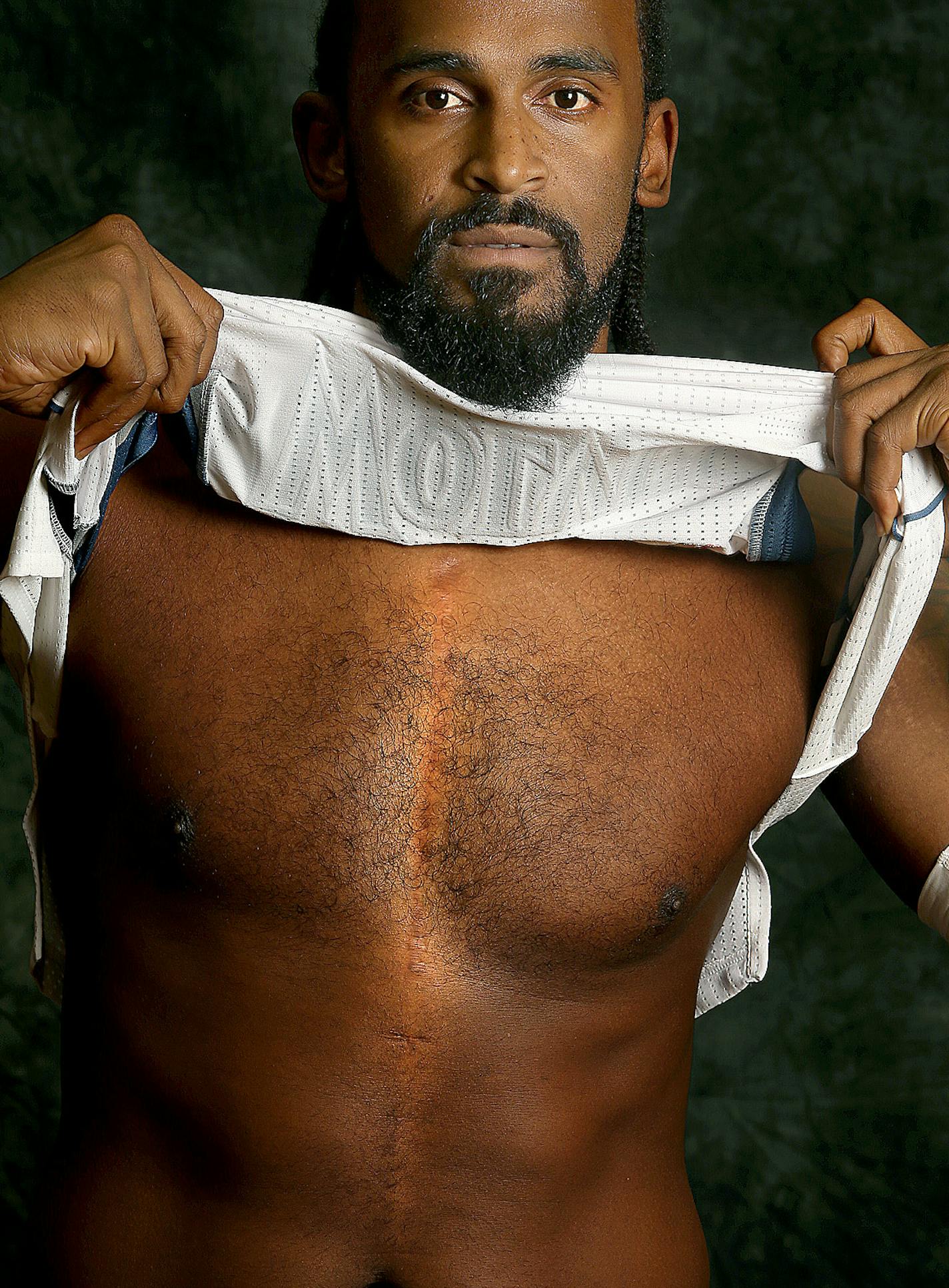 Minnesota Timberwolves' Ronnie Turiaf revealed a scar from his heart surgery during Media Day at the Target Center, Monday, September 30, 2013 in Minneapolis, MN. (ELIZABETH FLORES/STAR TRIBUNE) ELIZABETH FLORES &#x2022; eflores@startribune.com