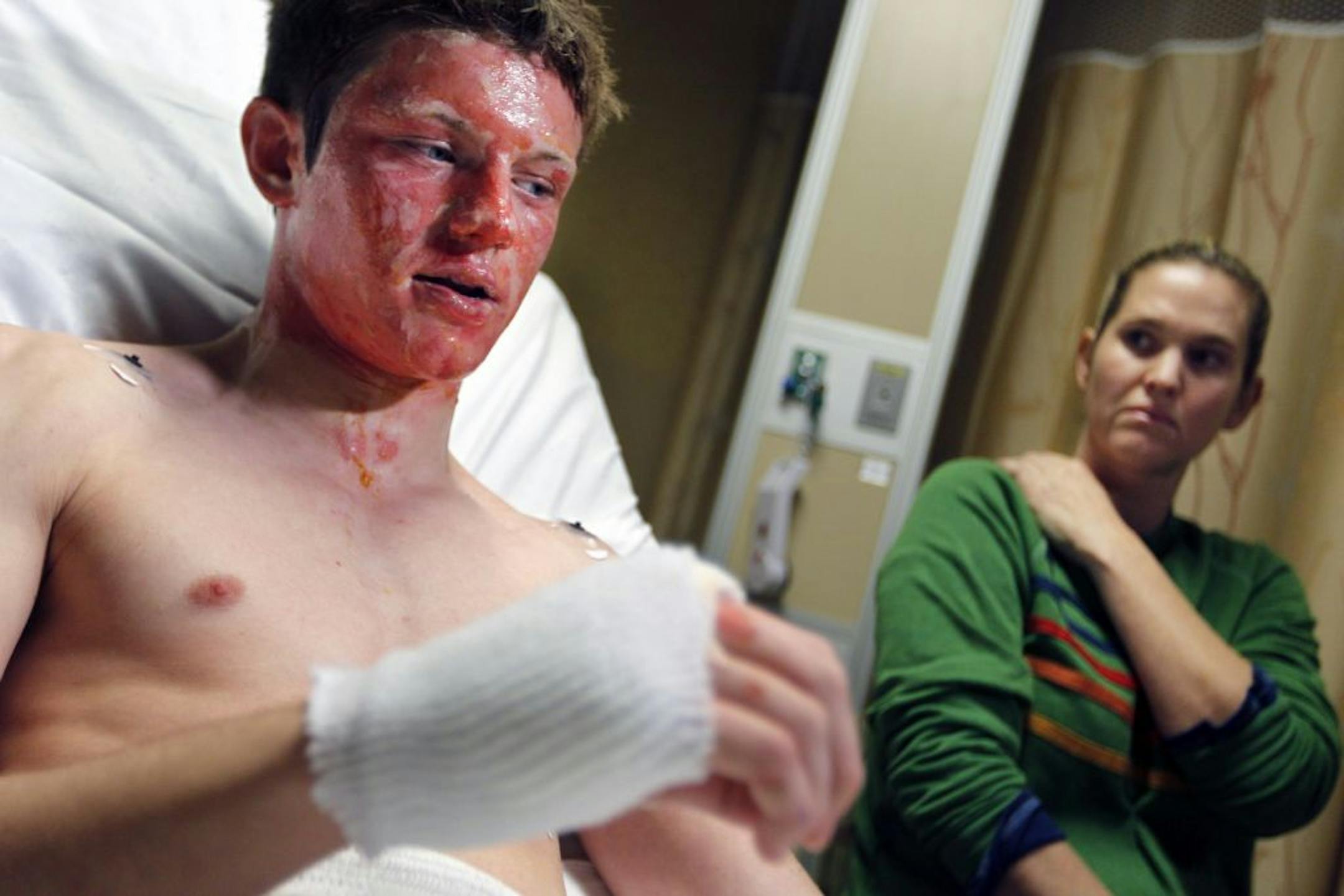 At HCMC, Maple Grove Jr. H.S. student Dane Neuberger suffered burns to his face and hands talked to reporters while surrounded by his mother Lisa .