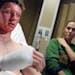At HCMC, Maple Grove Jr. H.S. student Dane Neuberger suffered burns to his face and hands talked to reporters while surrounded by his mother Lisa .