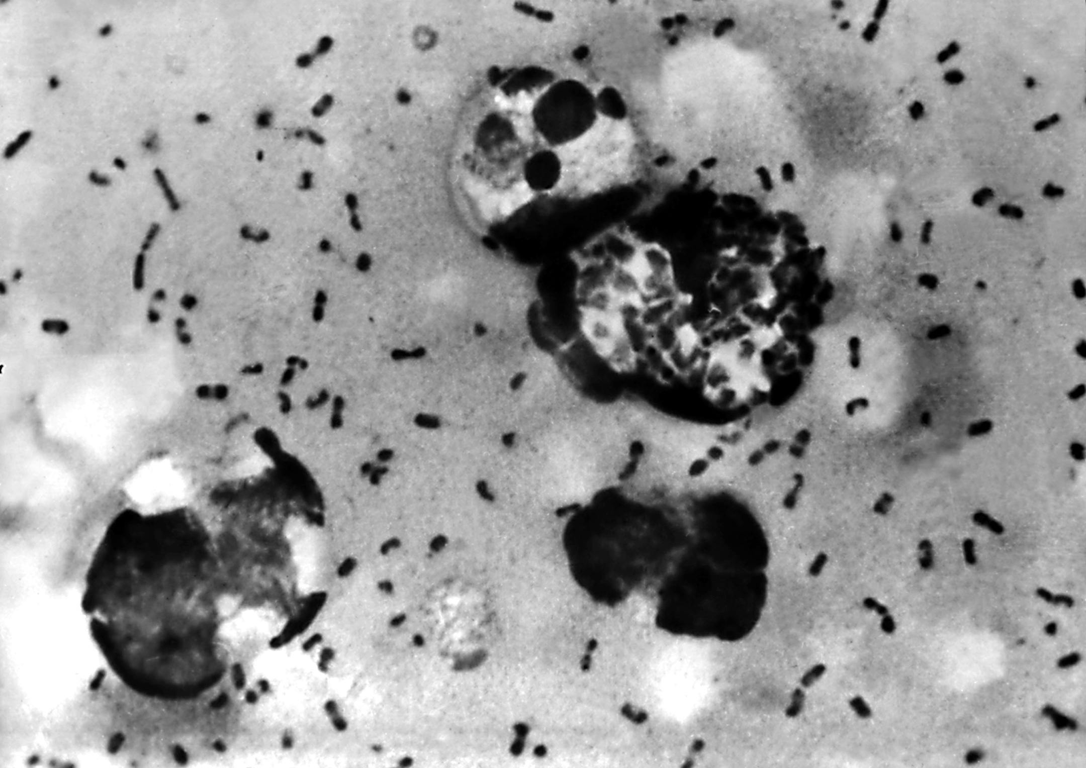 A bubonic plague smear, prepared from a lymph removed from an adenopathic lymph node, or bubo, of a plague patient, demonstrates the presence of the Yersinia pestis bacteria that causes the plague in this undated photo. The FBI has confirmed that about 30 vials that may contain bacteria that could cause bubonic or pneumonic plague have gone missing, then found, from the Health Sciences Center at Texas Tech University Jan. 15, 2003 in Lubbock, Tx. The plague, considered a likely bioterror agent s