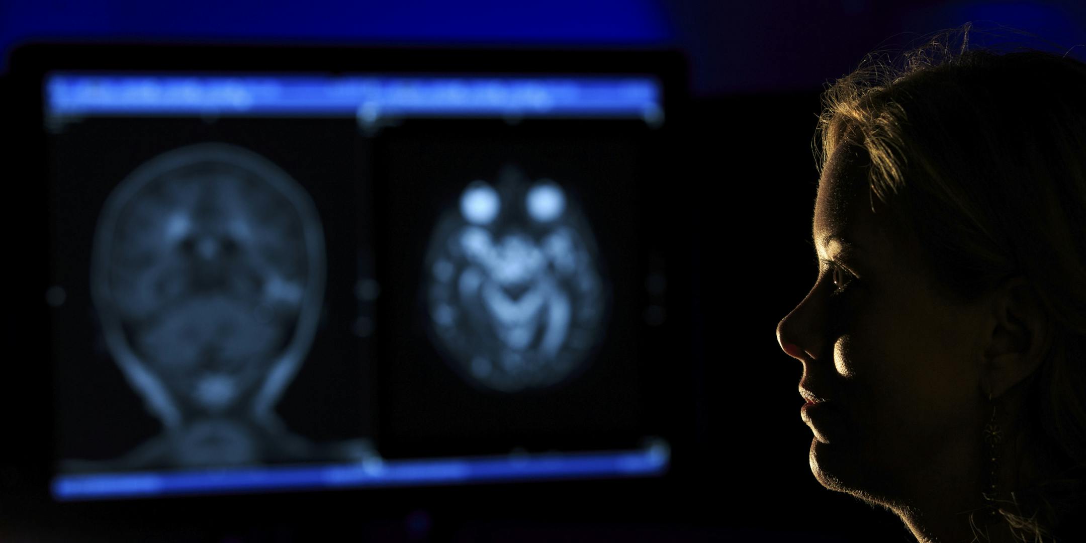 Dr. Jennifer Kemp, a radiologist who strives to make her position more accessible to patients, in a scan room at Rose Medical Center in Denver, Oct. 29, 2014. Kemp hopes to make her case by demonstrating how some radiologists, herself included, have successfully managed to communicate with patients. (Justin Edmonds/The New York Times) ORG XMIT: XNYT80