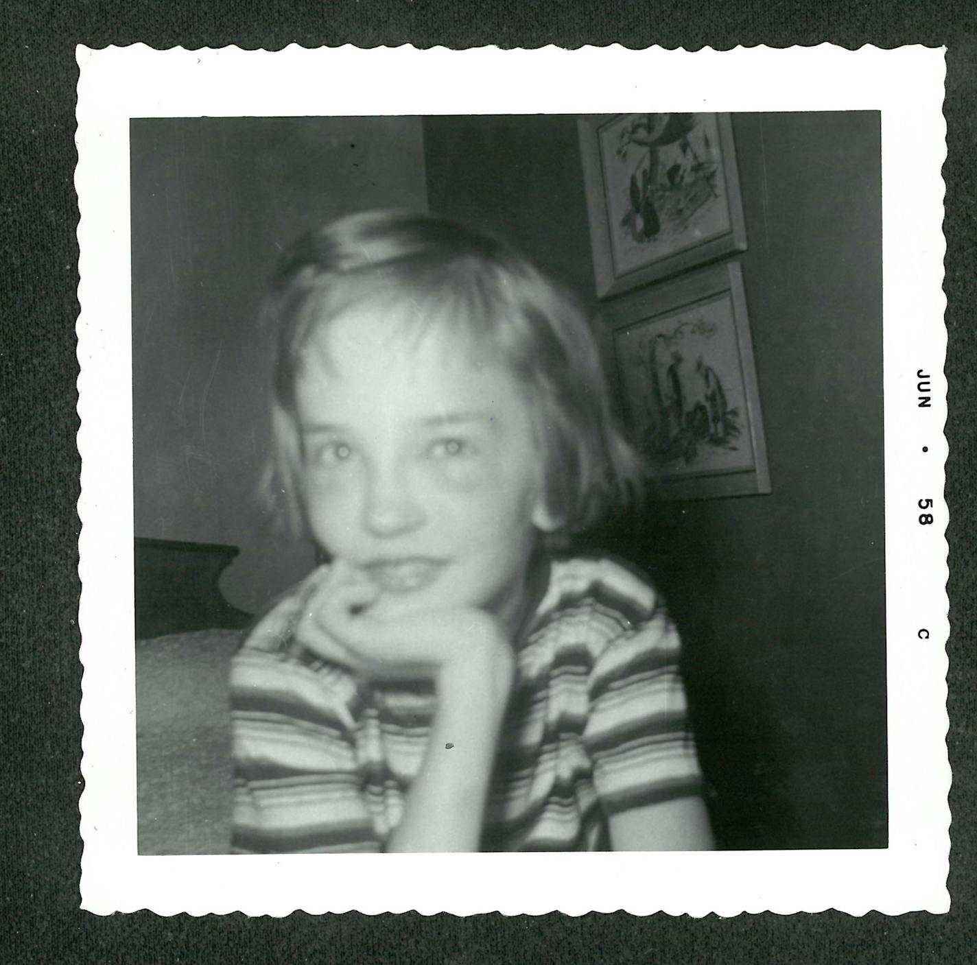 Janet Lee Dahl with yellow bags under her eyes after her latest fall. 1958