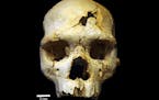 This is the frontal view of Cranium 17, a 500,000 skull that was discovered in a mass grave in Spain. Scientists say is may show the world's oldest re