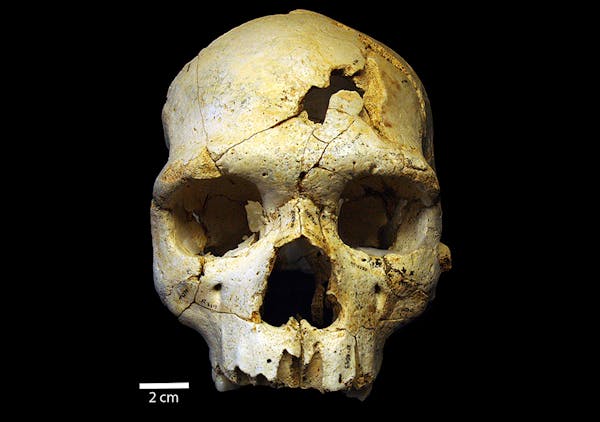 This is the frontal view of Cranium 17, a 500,000 skull that was discovered in a mass grave in Spain. Scientists say is may show the world's oldest re