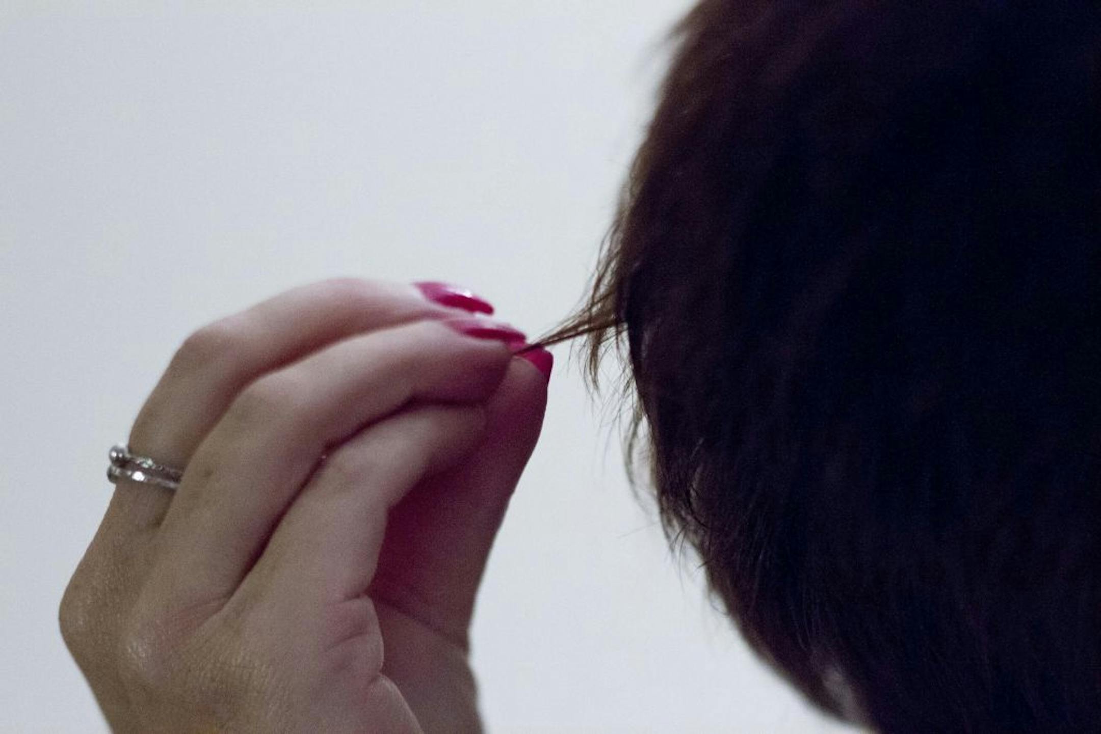 Laurie Piotrowski, who suffers from trichotillomania, hair pulling, shows how she rolls her hair before pulling it out.