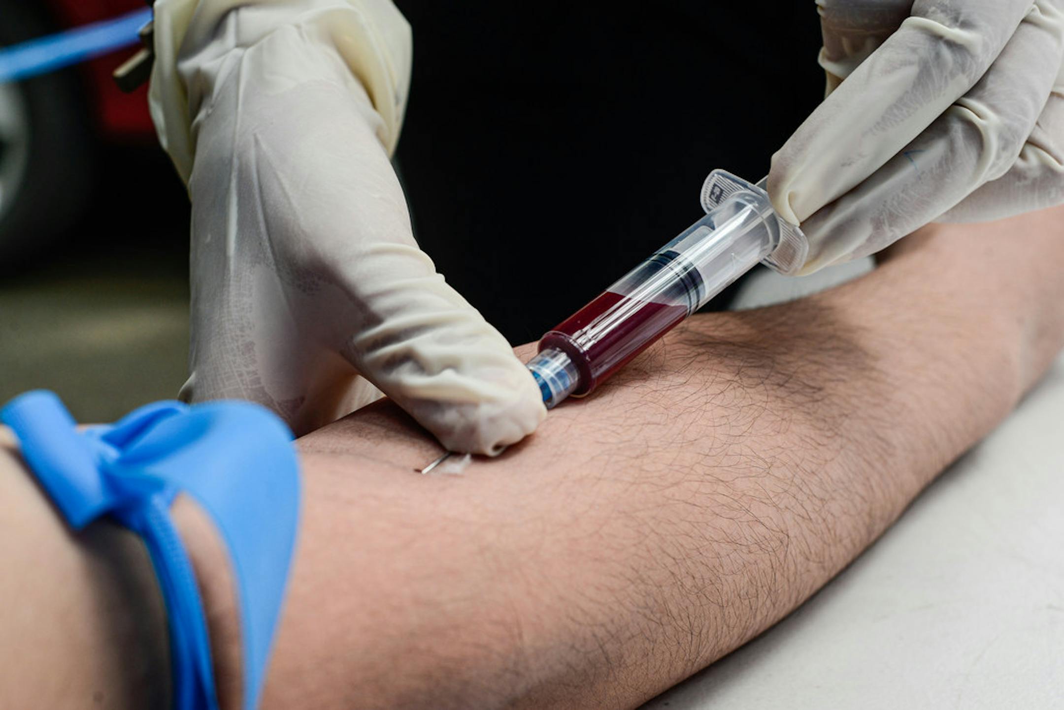 A volunteer medical technologist takes a test blood sample from a student who volunteered for a free HIV testing program in 2019.