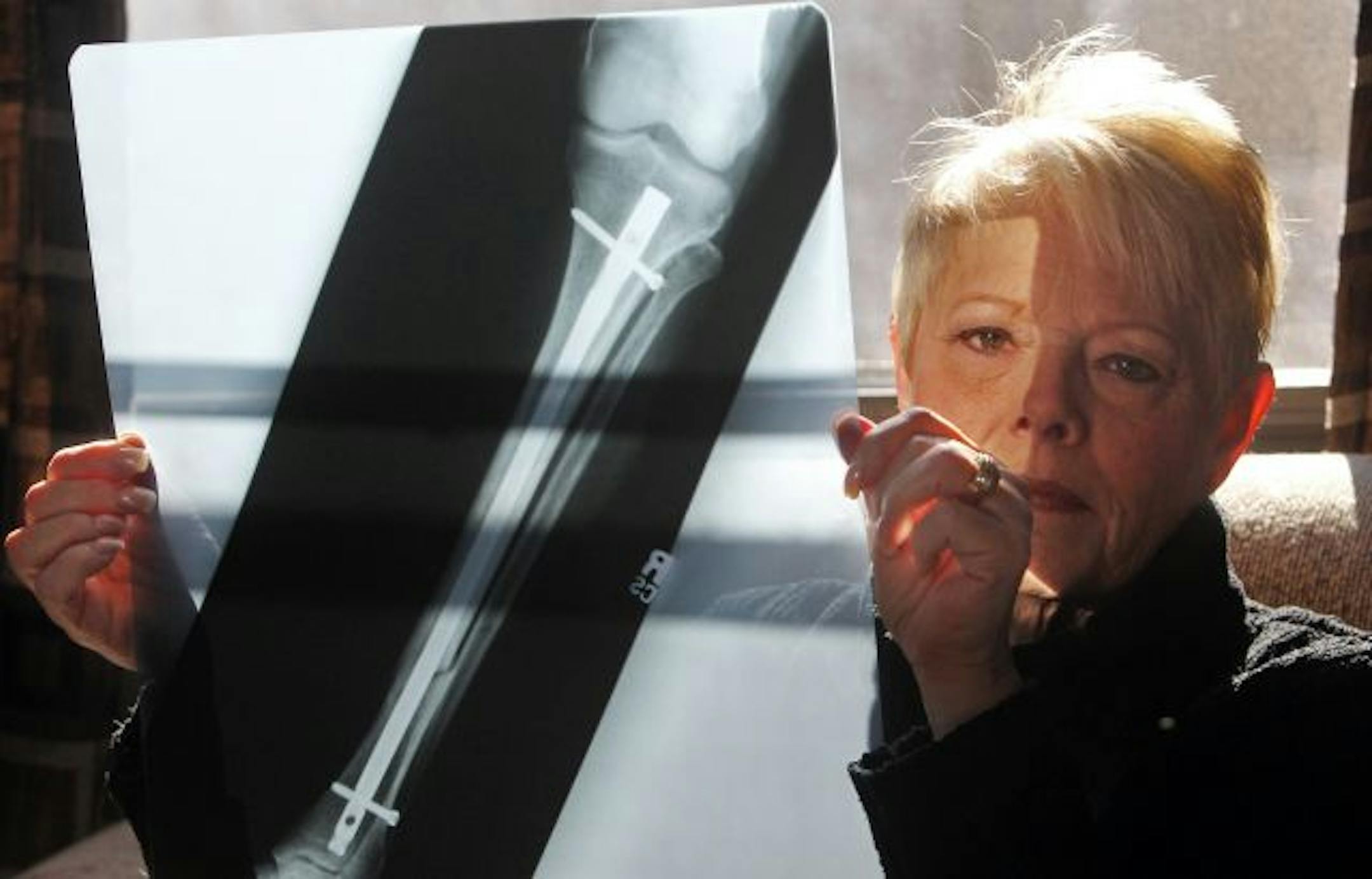 Two years ago, Barbara Anderson slipped on a patch of ice in the parking lot of Denny's in Coon Rapids and severely injured her back and broke her leg. The culprit: icy buildup from a downspout that emptied directly into the handicapped parking space where she was parked. Threatened with a lawsuit, Denny's paid Anderson's medical bills as well as money for pain and suffering. But two years later, the downspout hasn't been moved, and as recently as last week, the ice was thick, though pockmarked